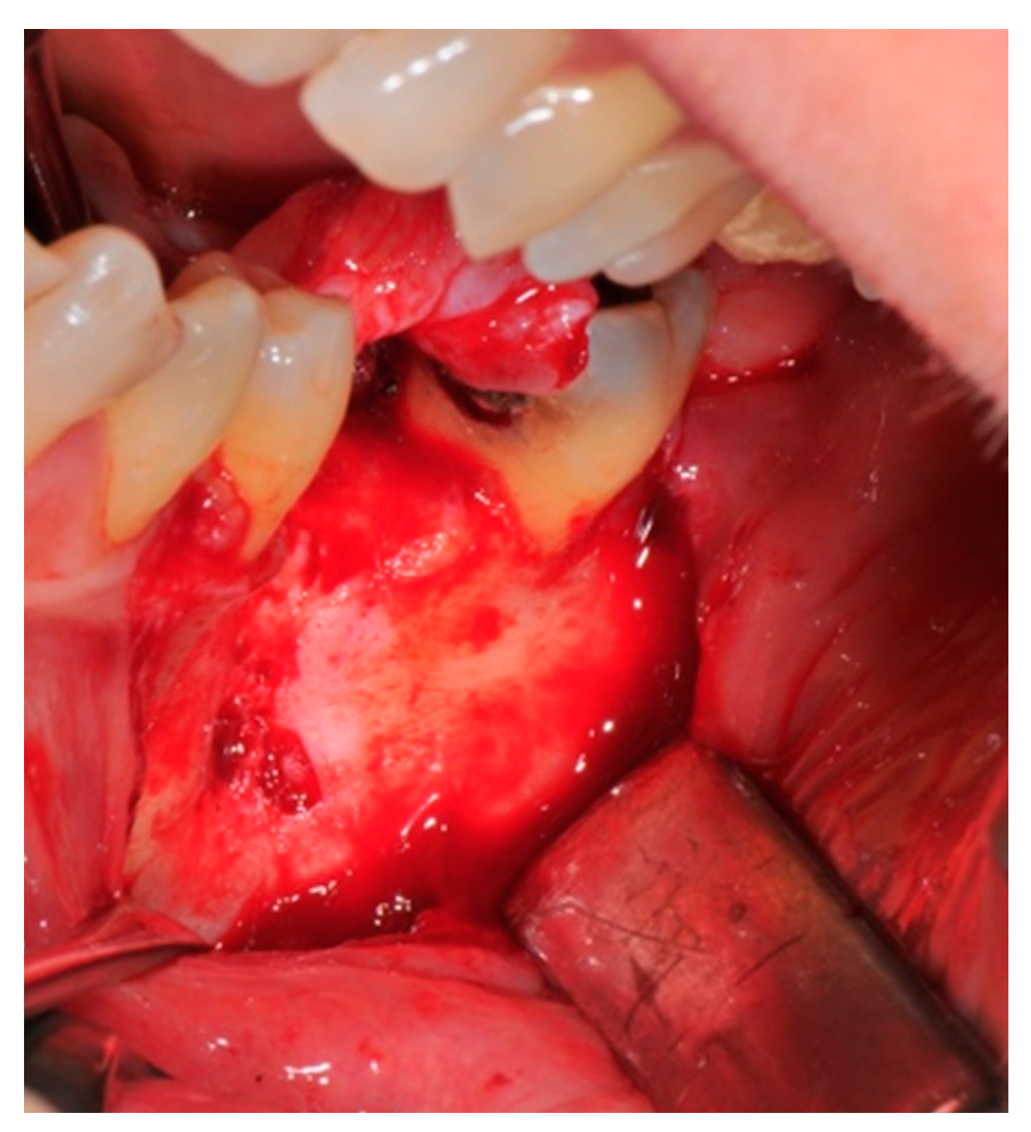 Medicina 57 00060 g005