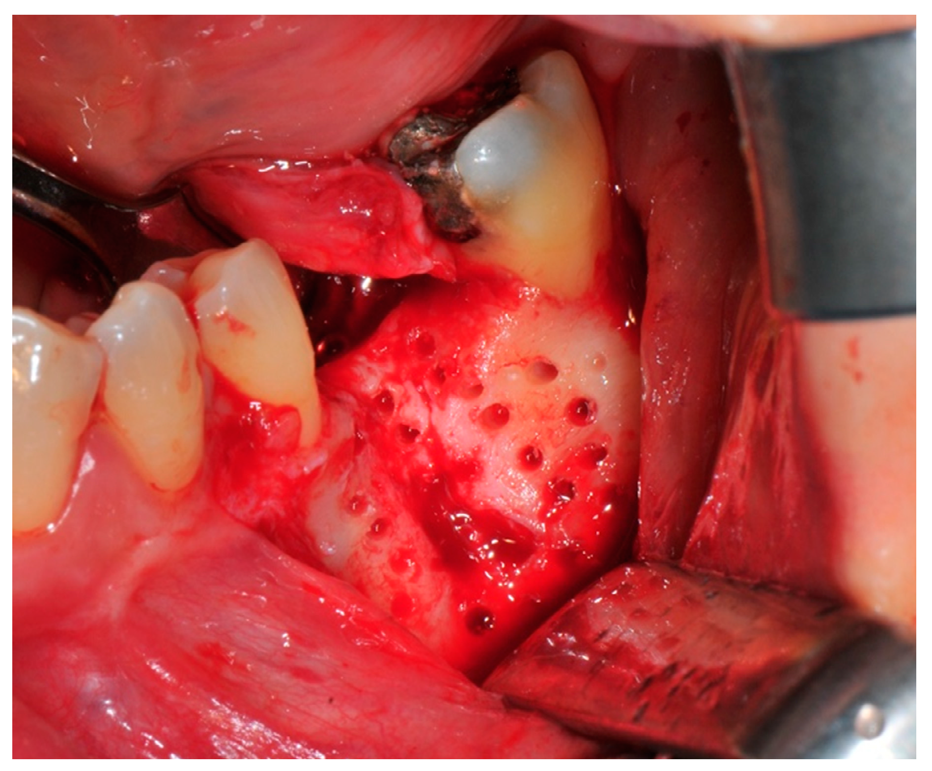 Medicina 57 00060 g006