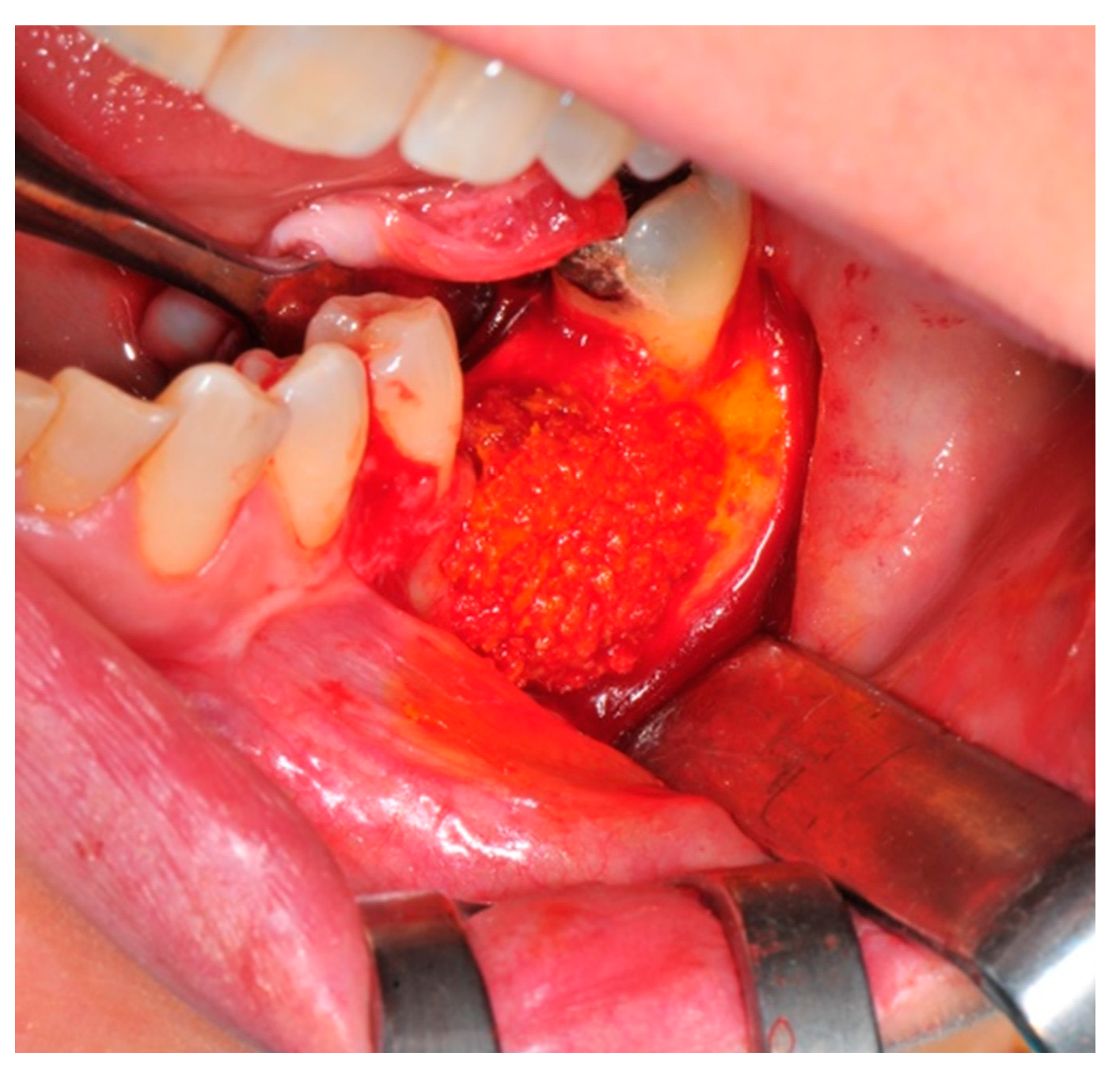 Medicina 57 00060 g007