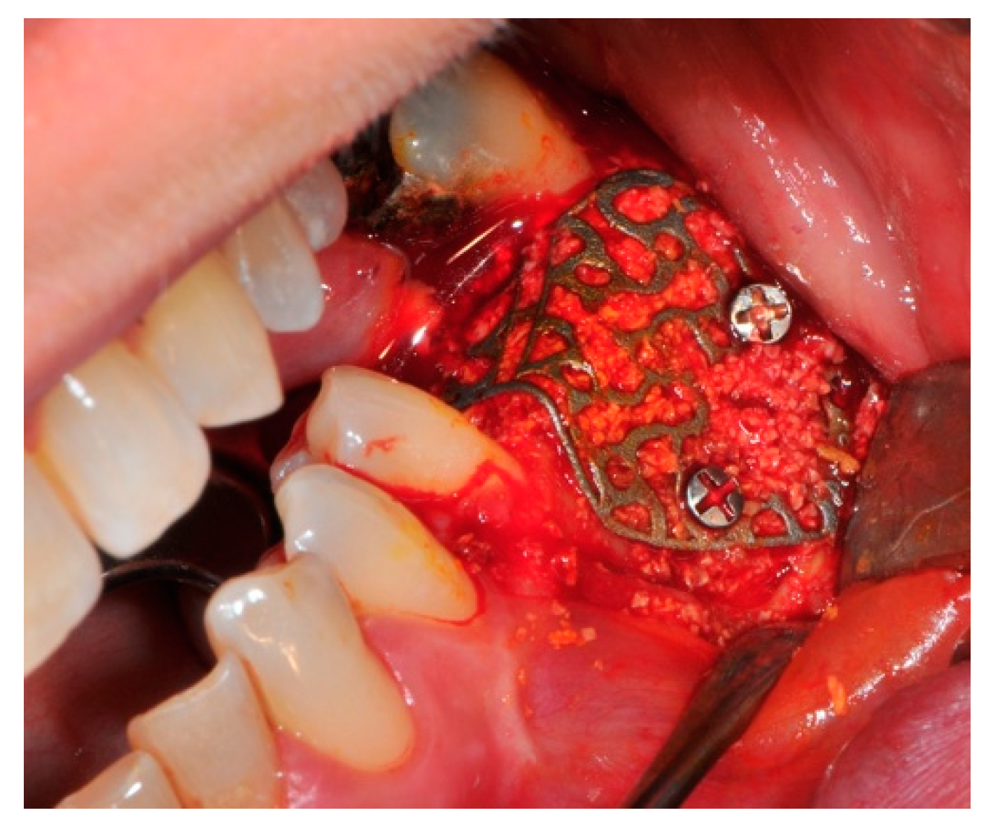 Medicina 57 00060 g008