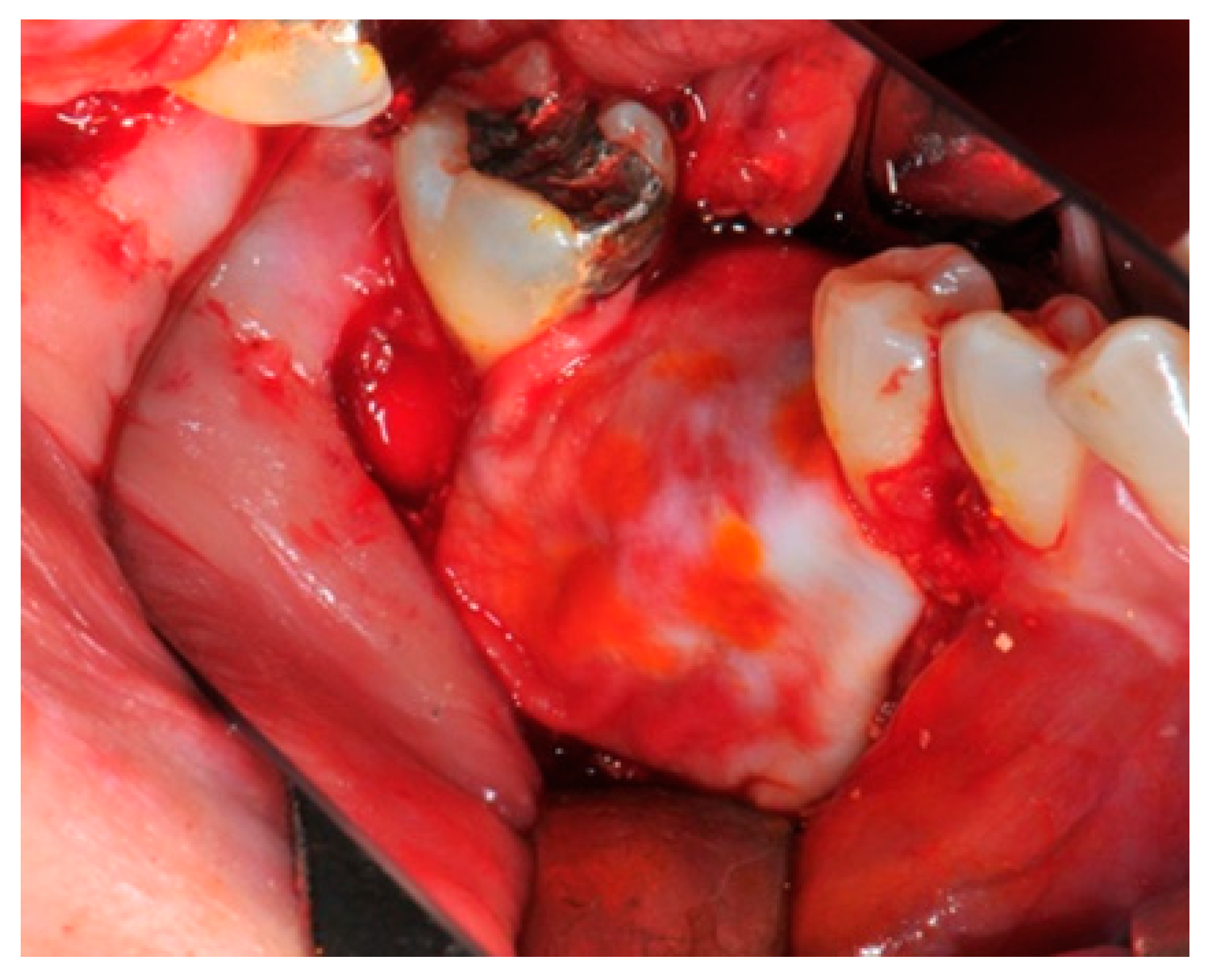 Medicina 57 00060 g010