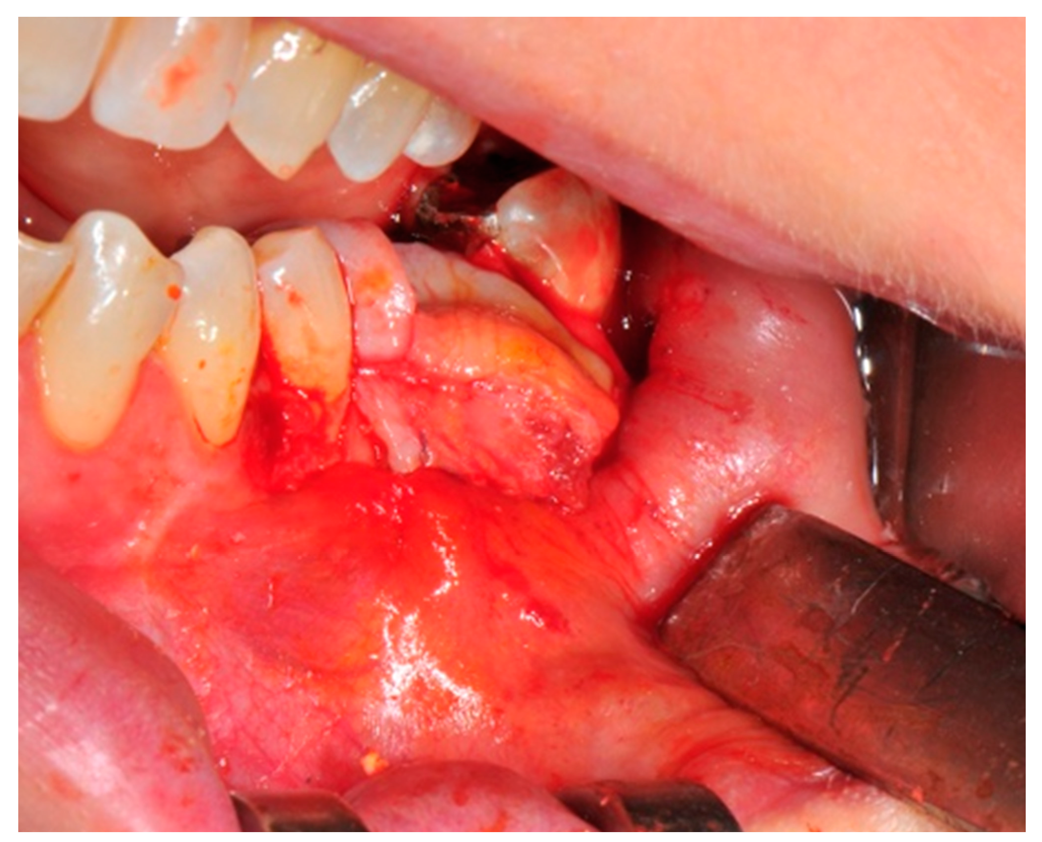 Medicina 57 00060 g011