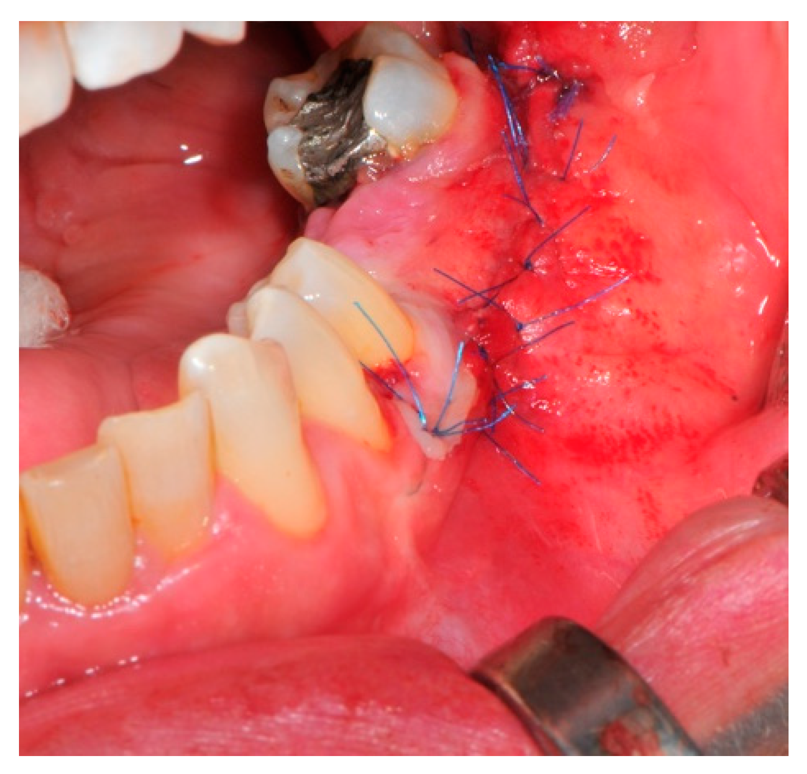 Medicina 57 00060 g012