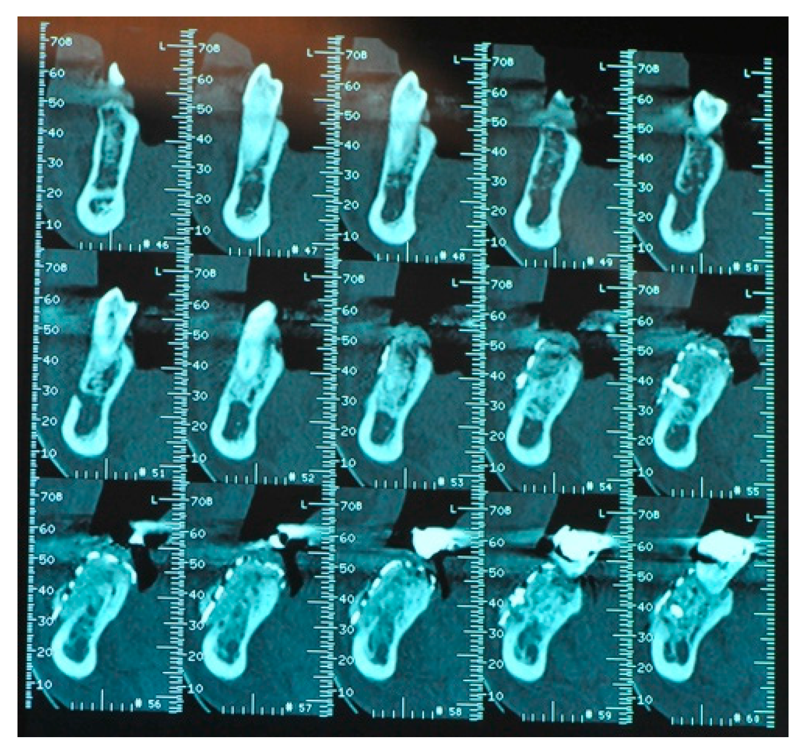 Medicina 57 00060 g014