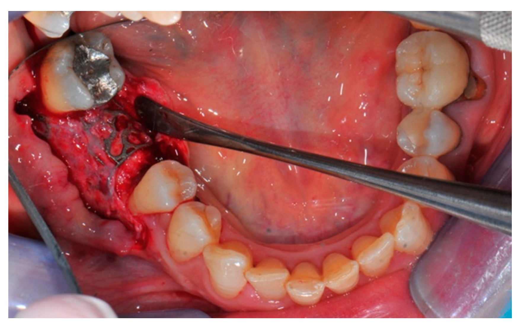 Medicina 57 00060 g016