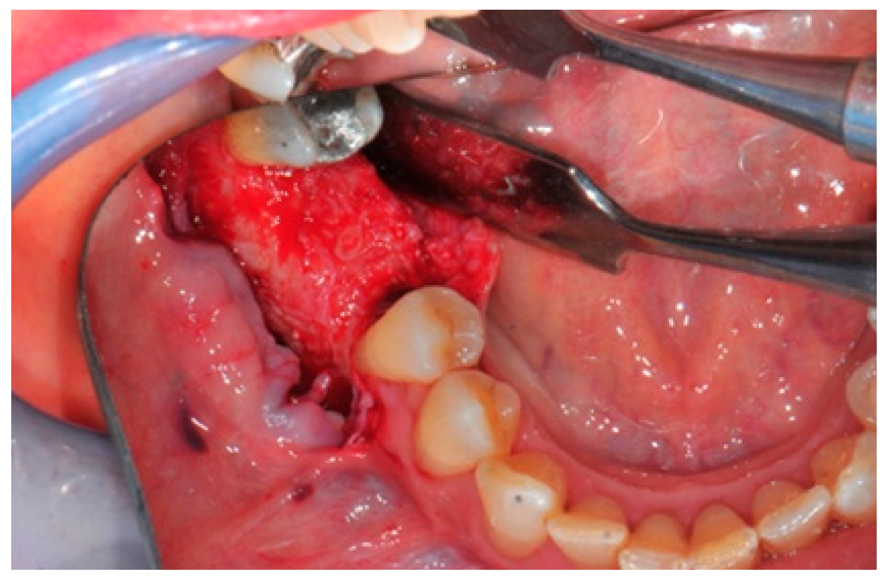 Medicina 57 00060 g017