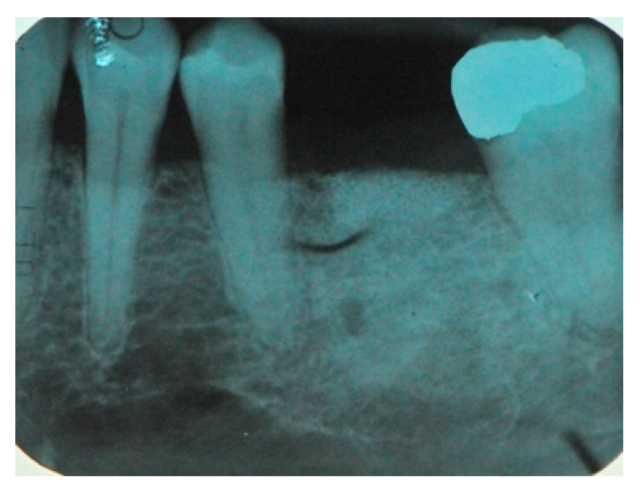 Medicina 57 00060 g018