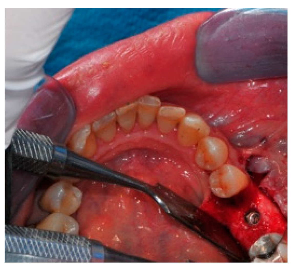 Medicina 57 00060 g019