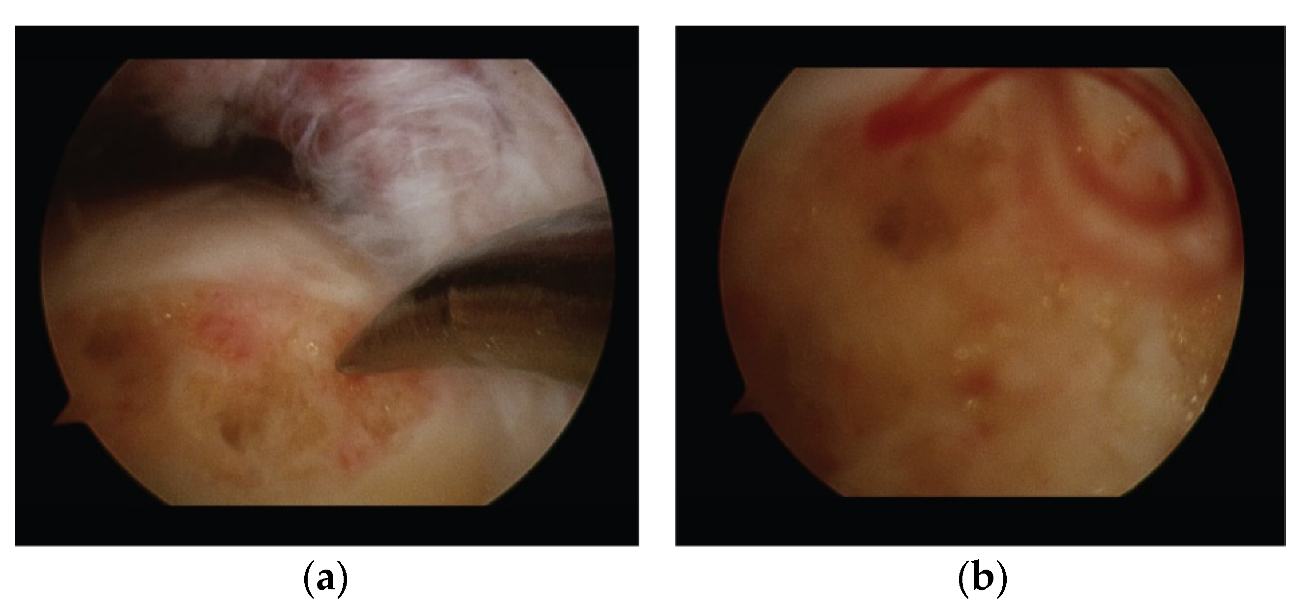 Medicina 57 00074 g003