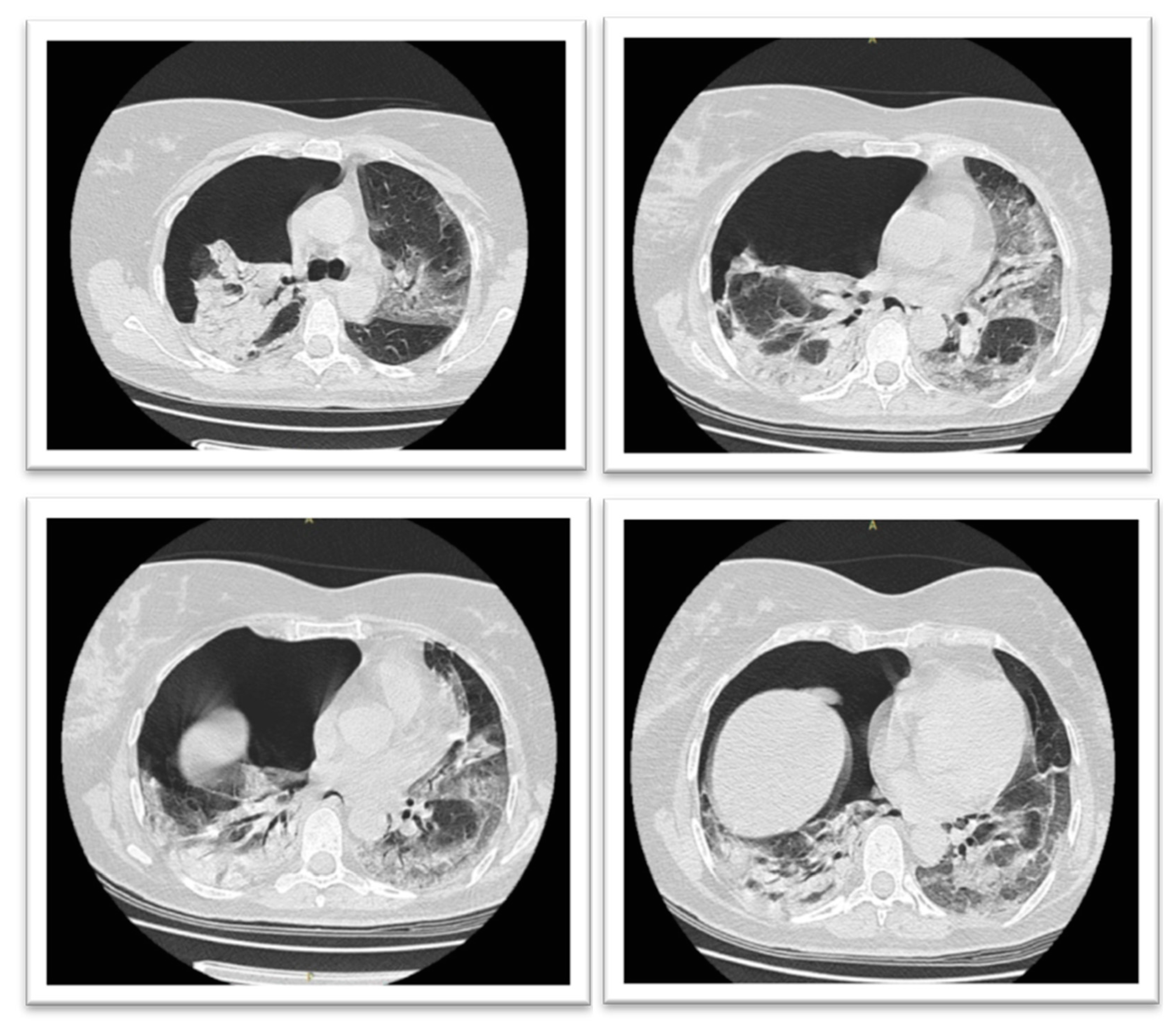 Medicina 57 00082 g001