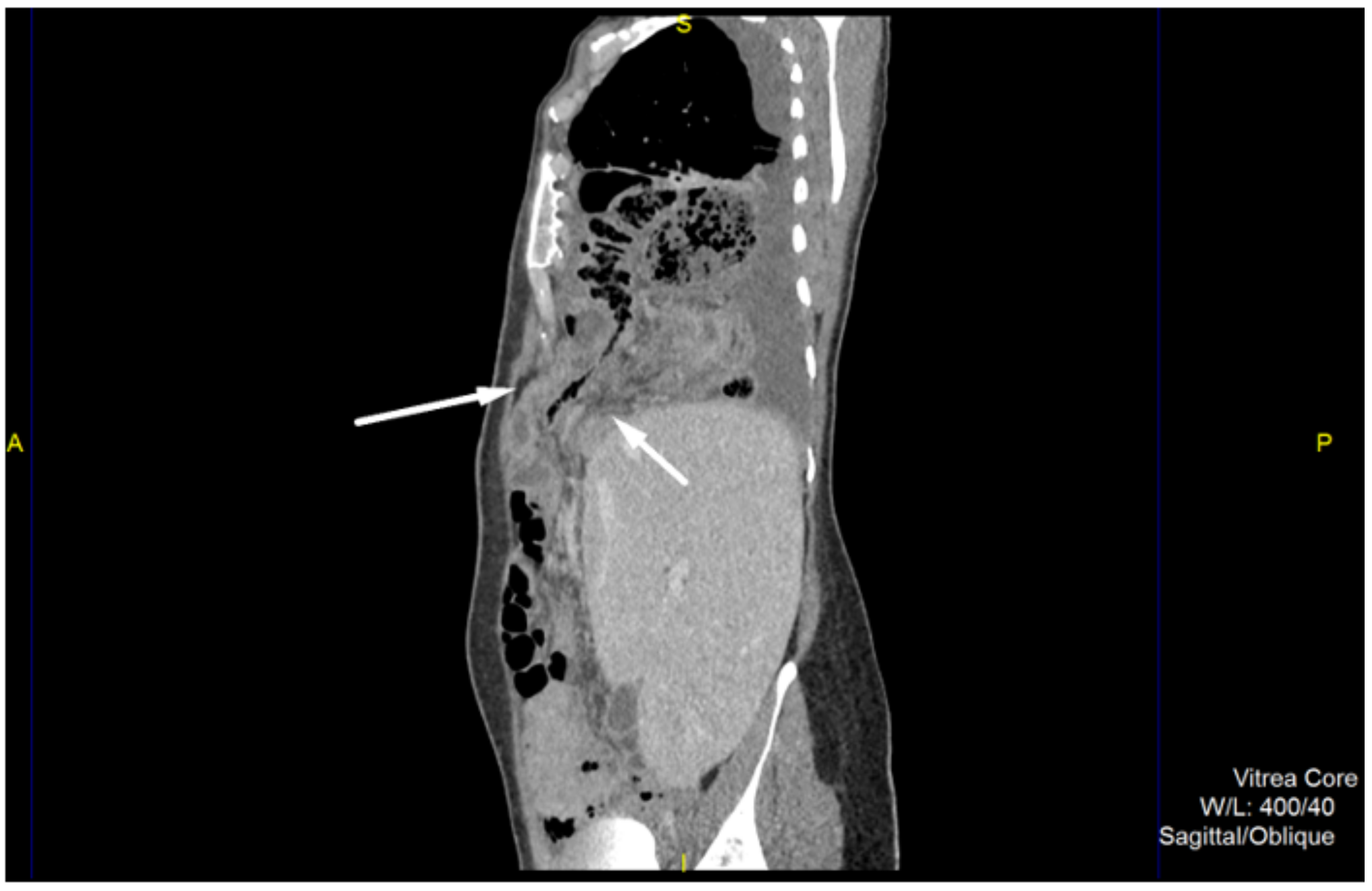 Medicina 57 00089 g001 Medicina 57 00089 g001