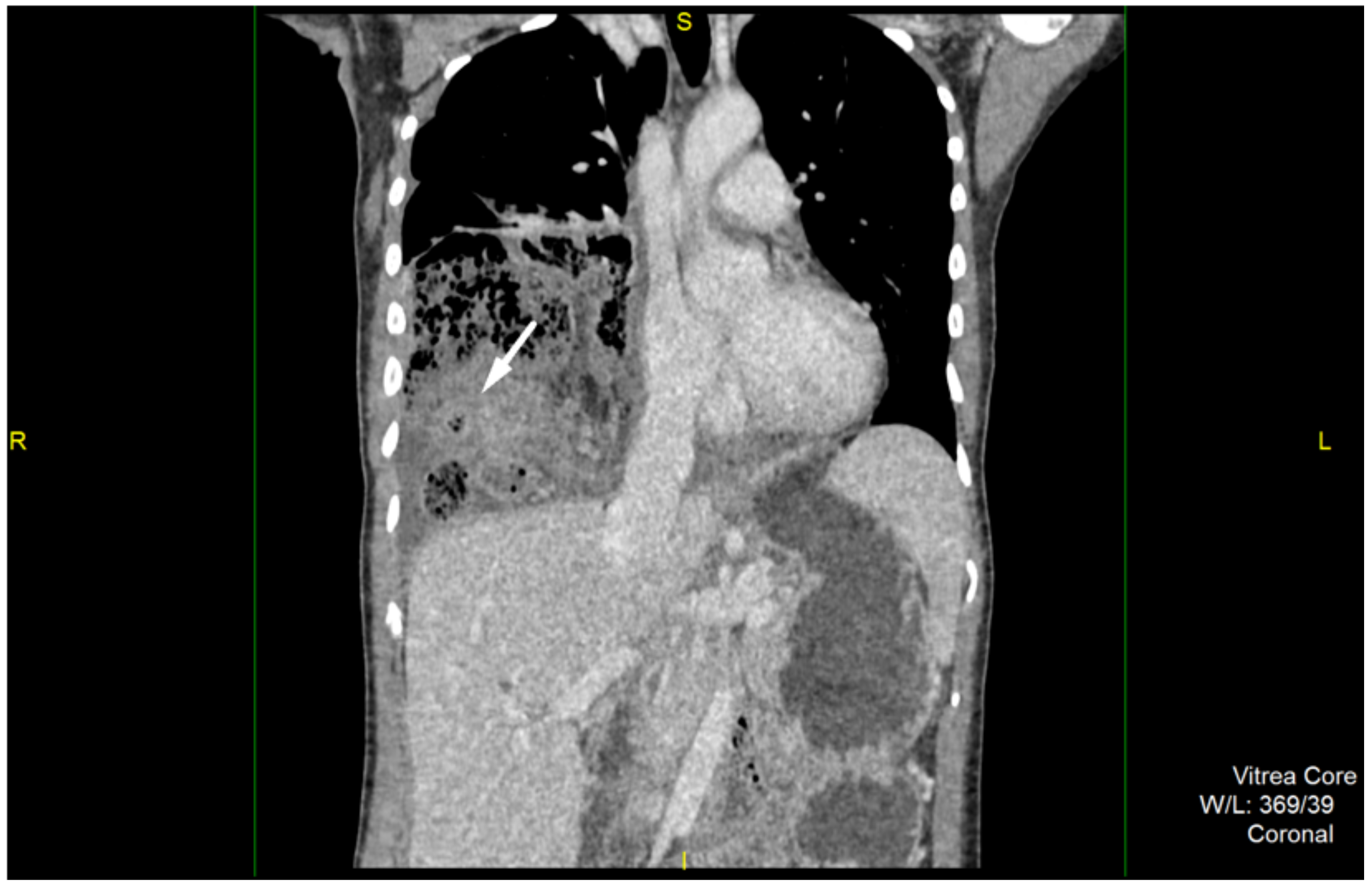 Medicina 57 00089 g002 Medicina 57 00089 g002