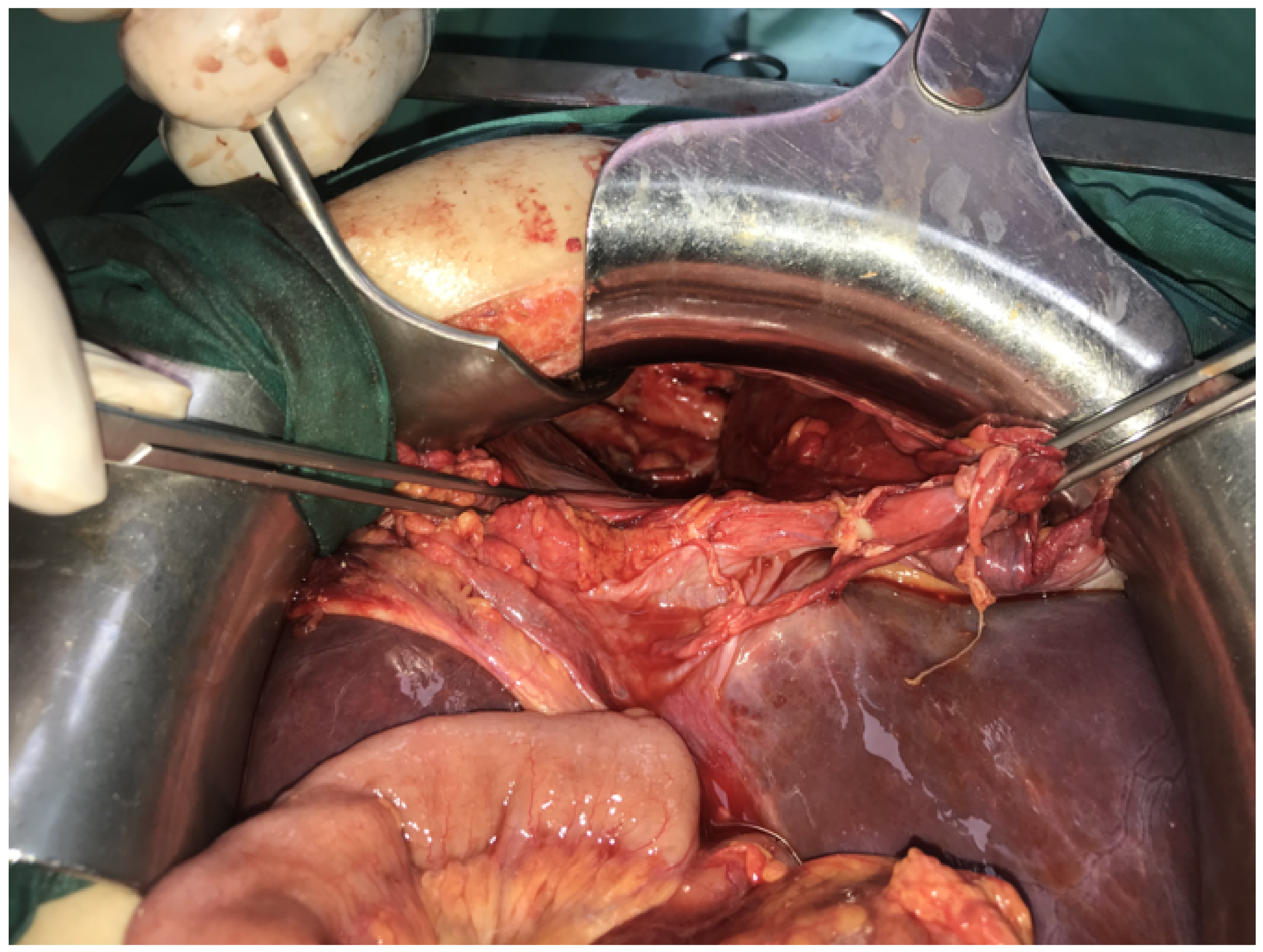 Medicina 57 00089 g004 Medicina 57 00089 g004