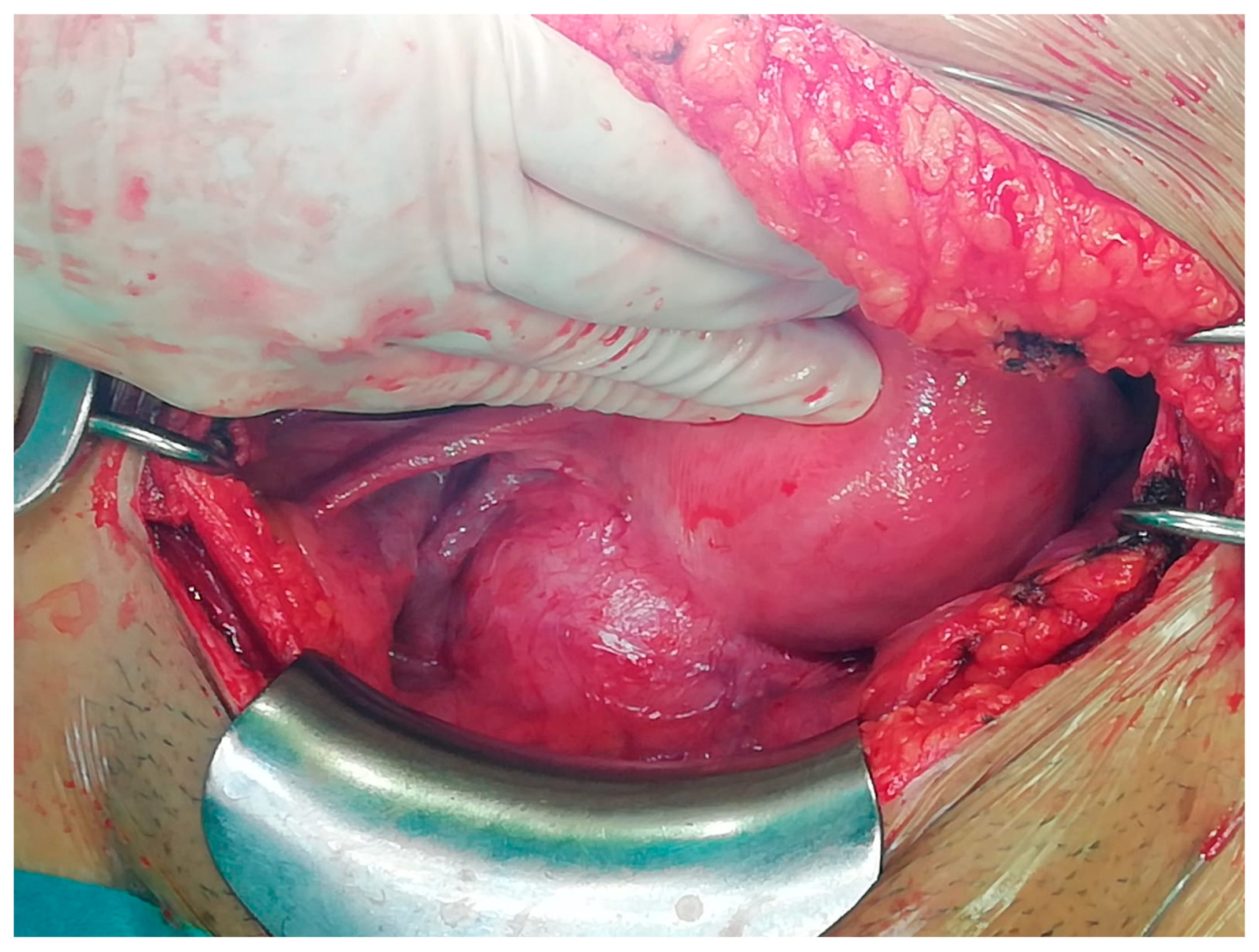 Medicina 57 00092 g002