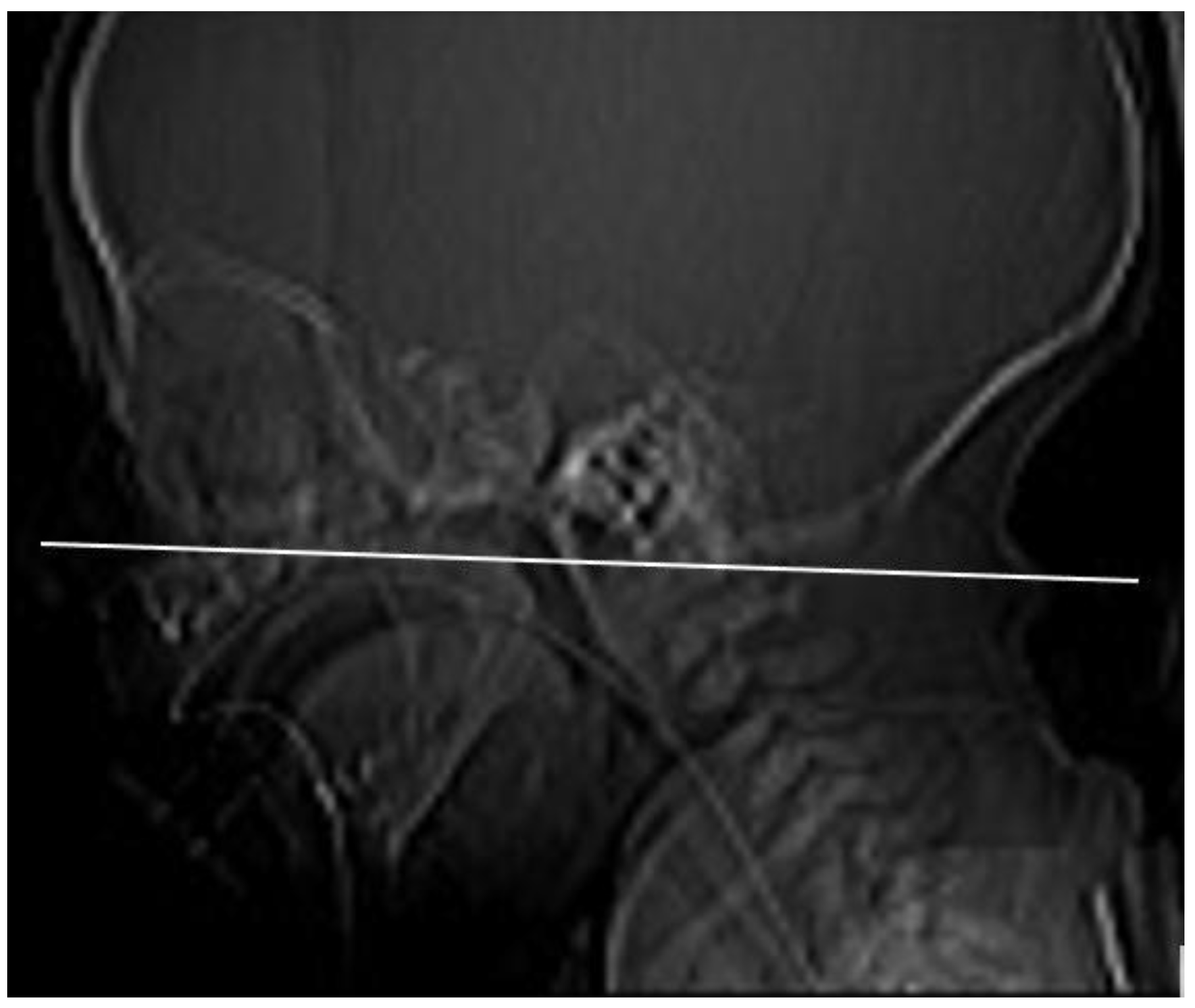 Medicina 57 00093 g001