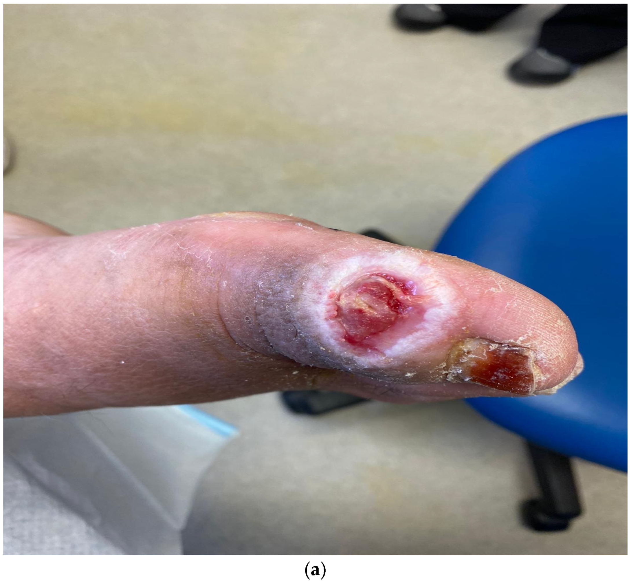 Medicina 57 00097 g001a