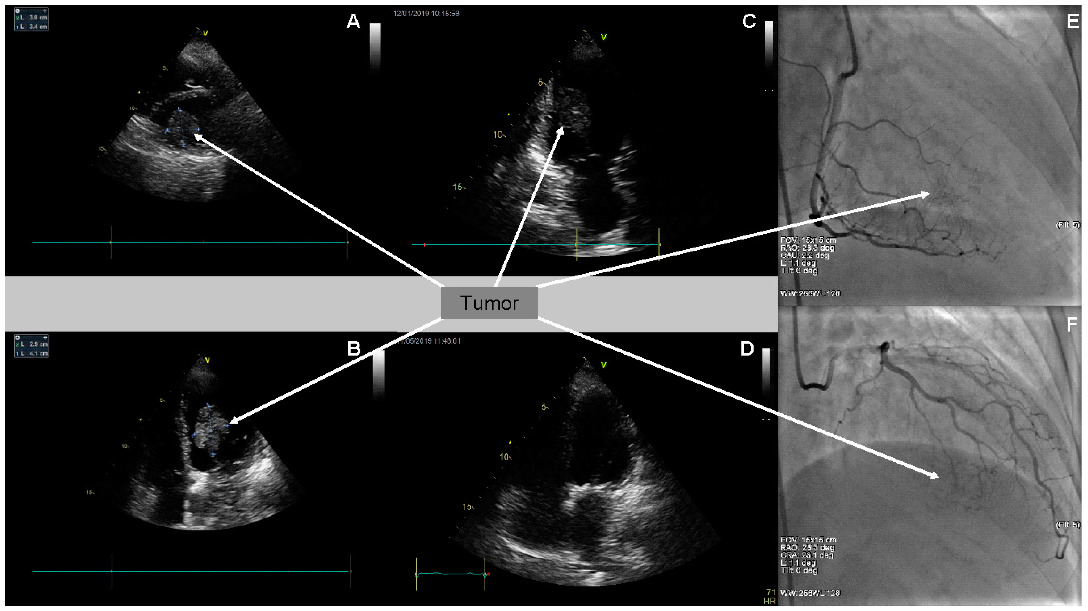 Medicina 57 00107 g001