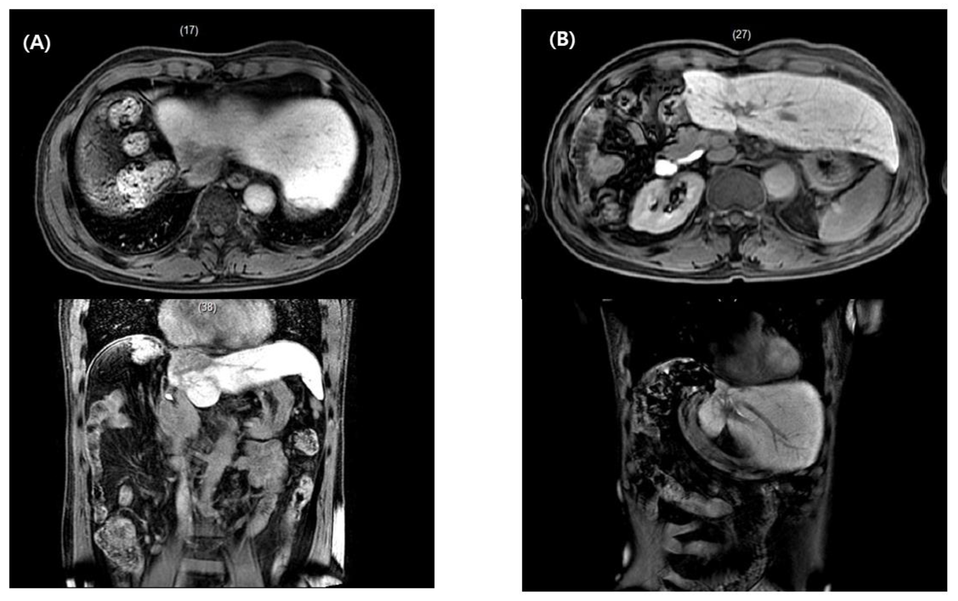 Medicina 57 00117 g003