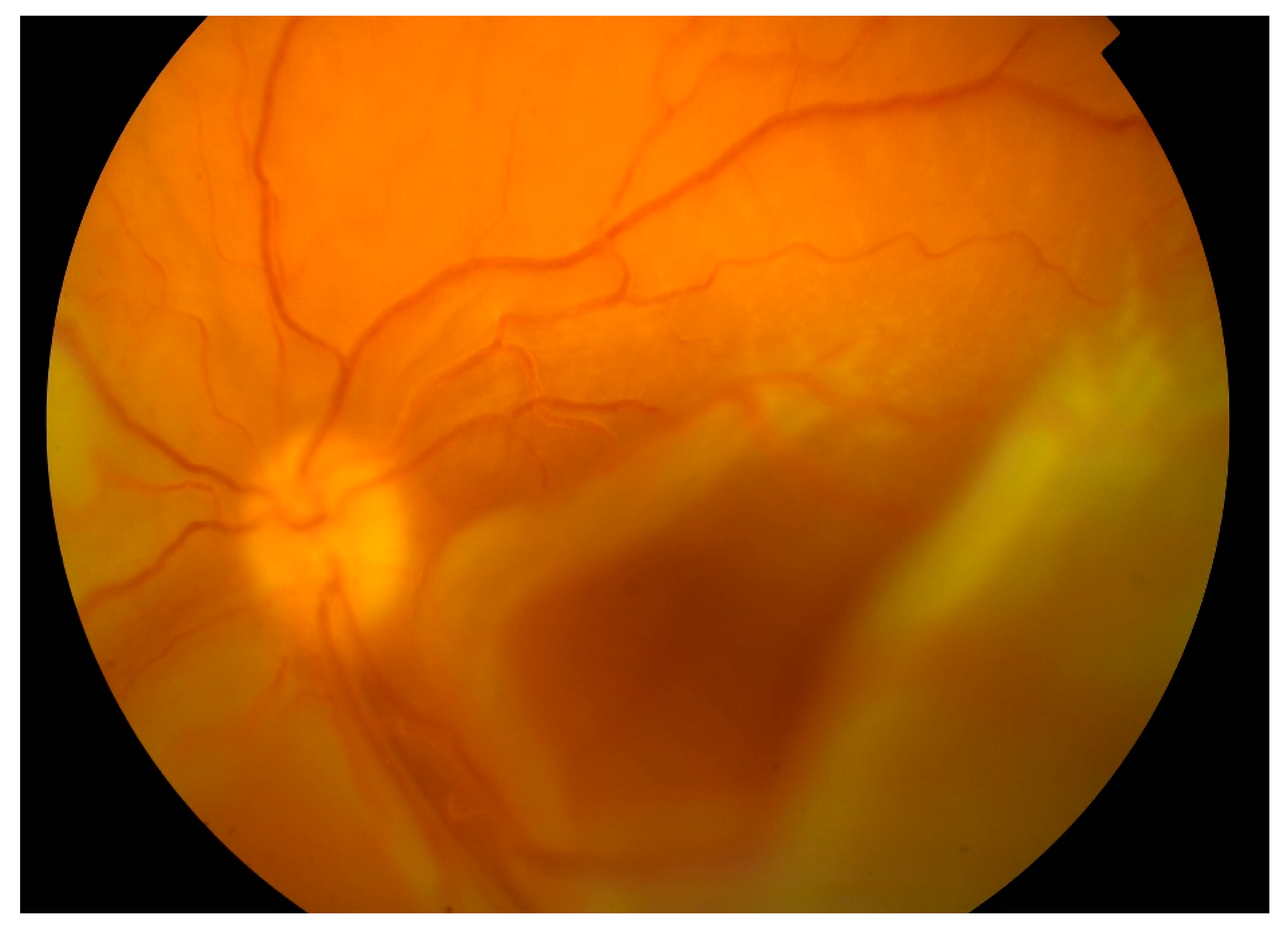 Medicina 57 00120 g004