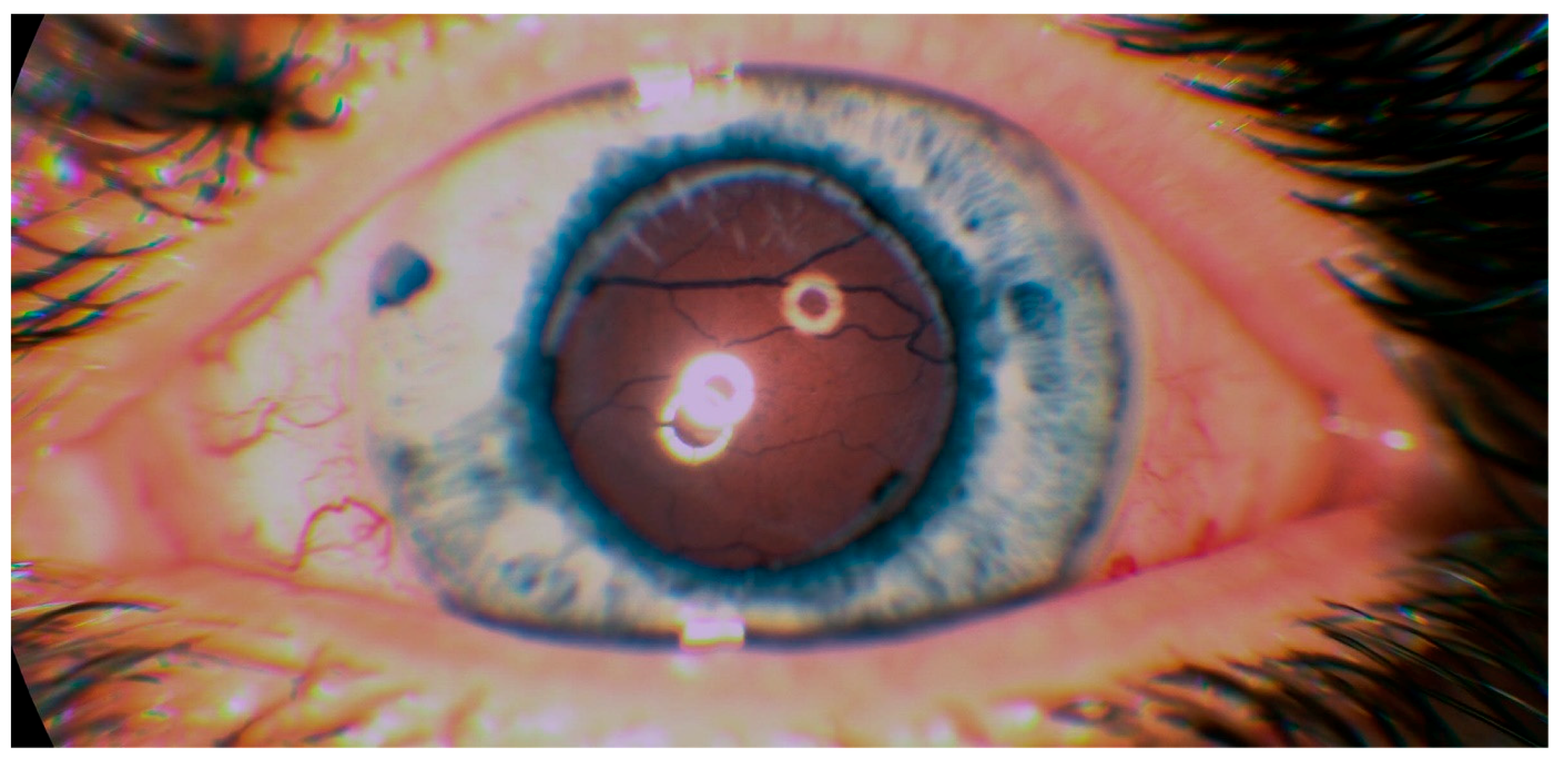 Medicina 57 00120 g005