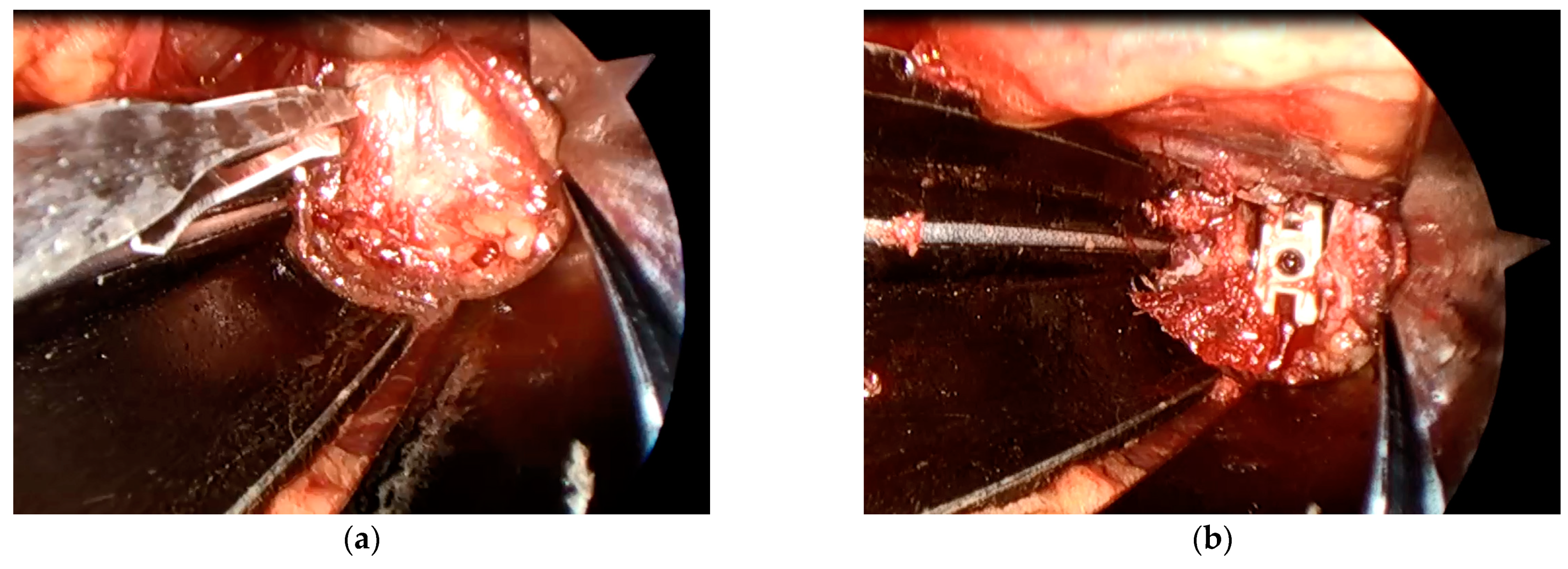 Medicina 57 00135 g002