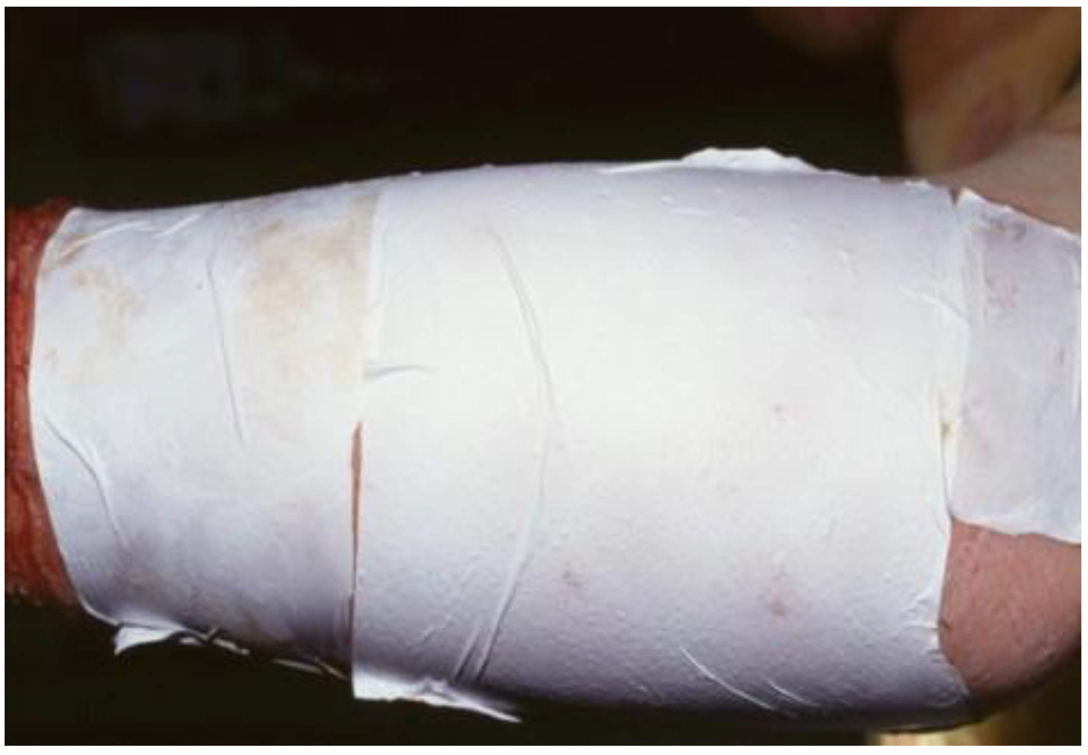 Medicina Free Full Text Made In Germany A Quality Indicator Not Only In The Automobile Industry But Also When It Comes To Skin Replacement How An Automobile Textile Research Institute Developed