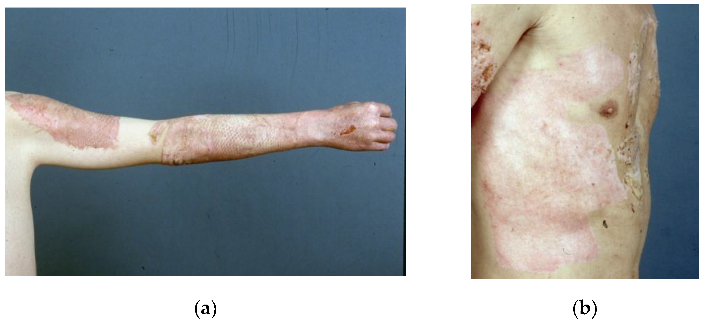 Medicina 57 00143 g002