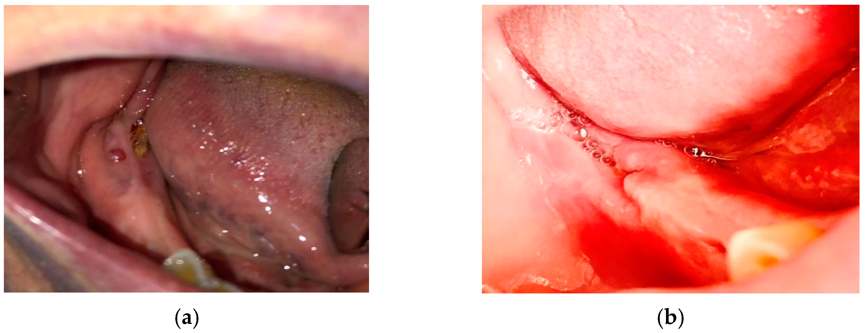 Medicina 57 00145 g004 Medicina 57 00145 g004