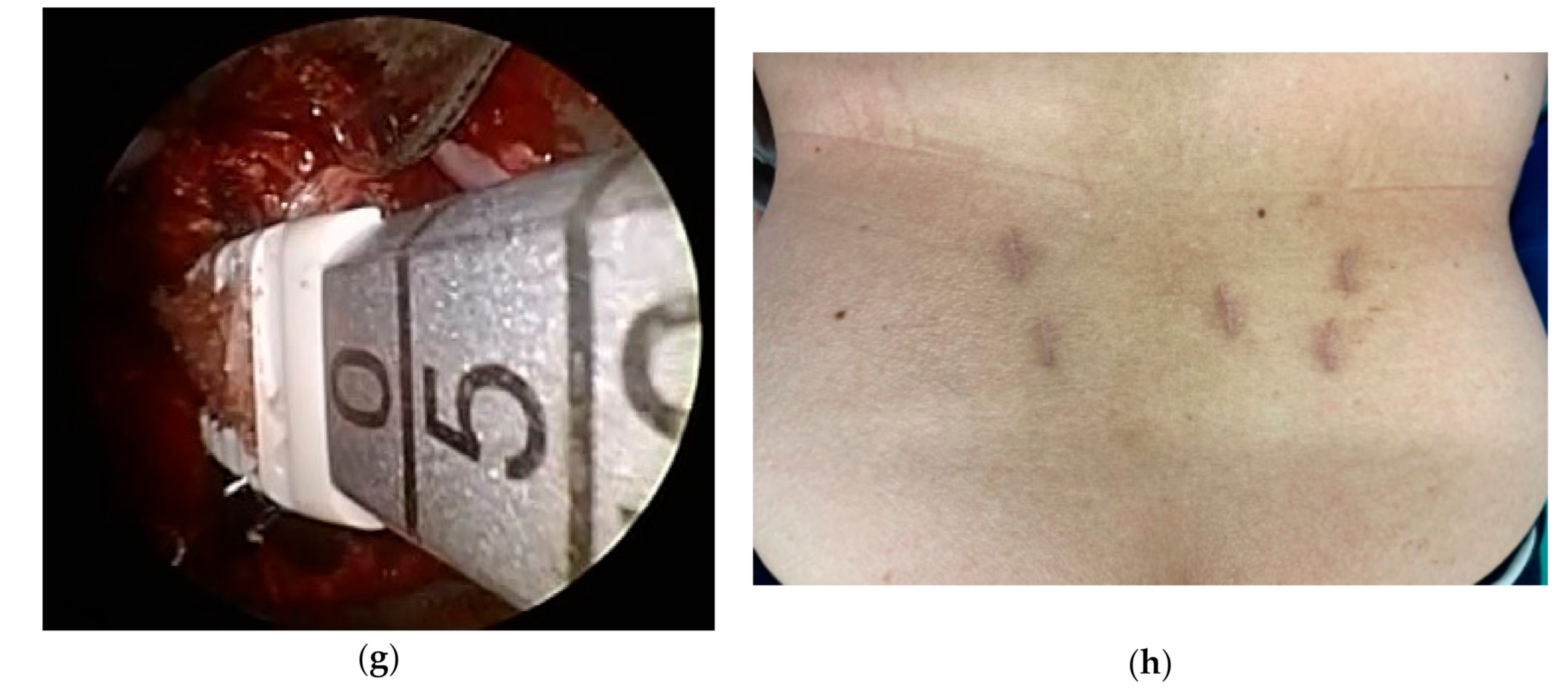 Medicina 57 00150 g001b