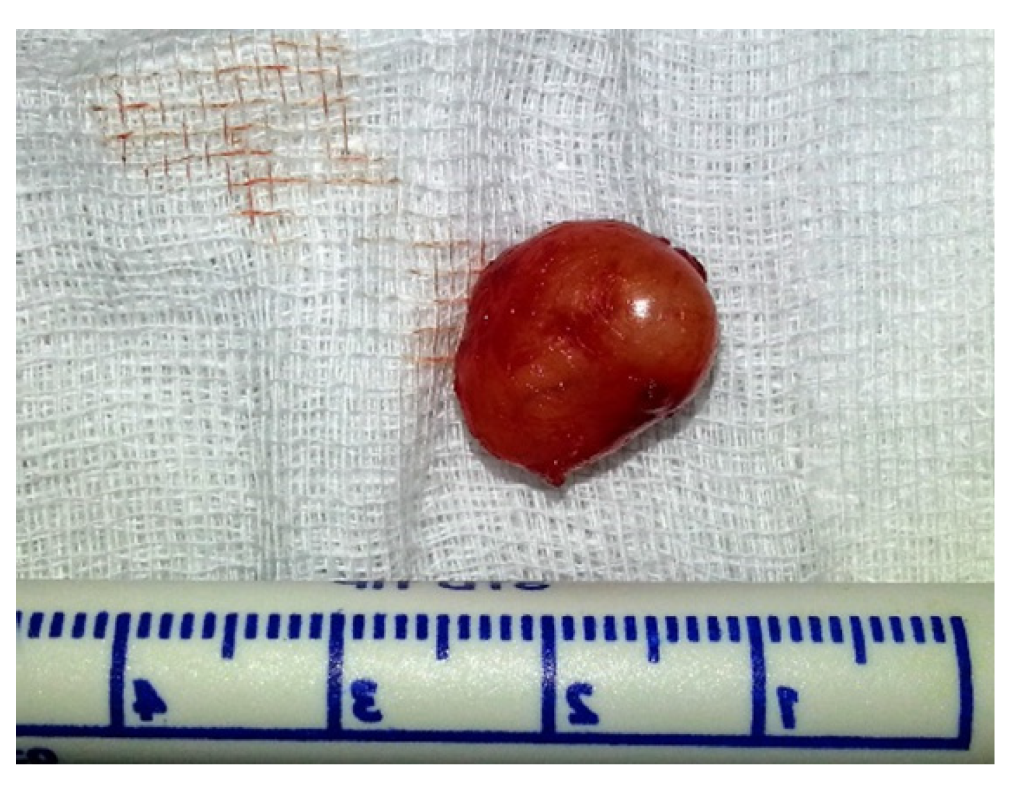 Medicina 57 00152 g002