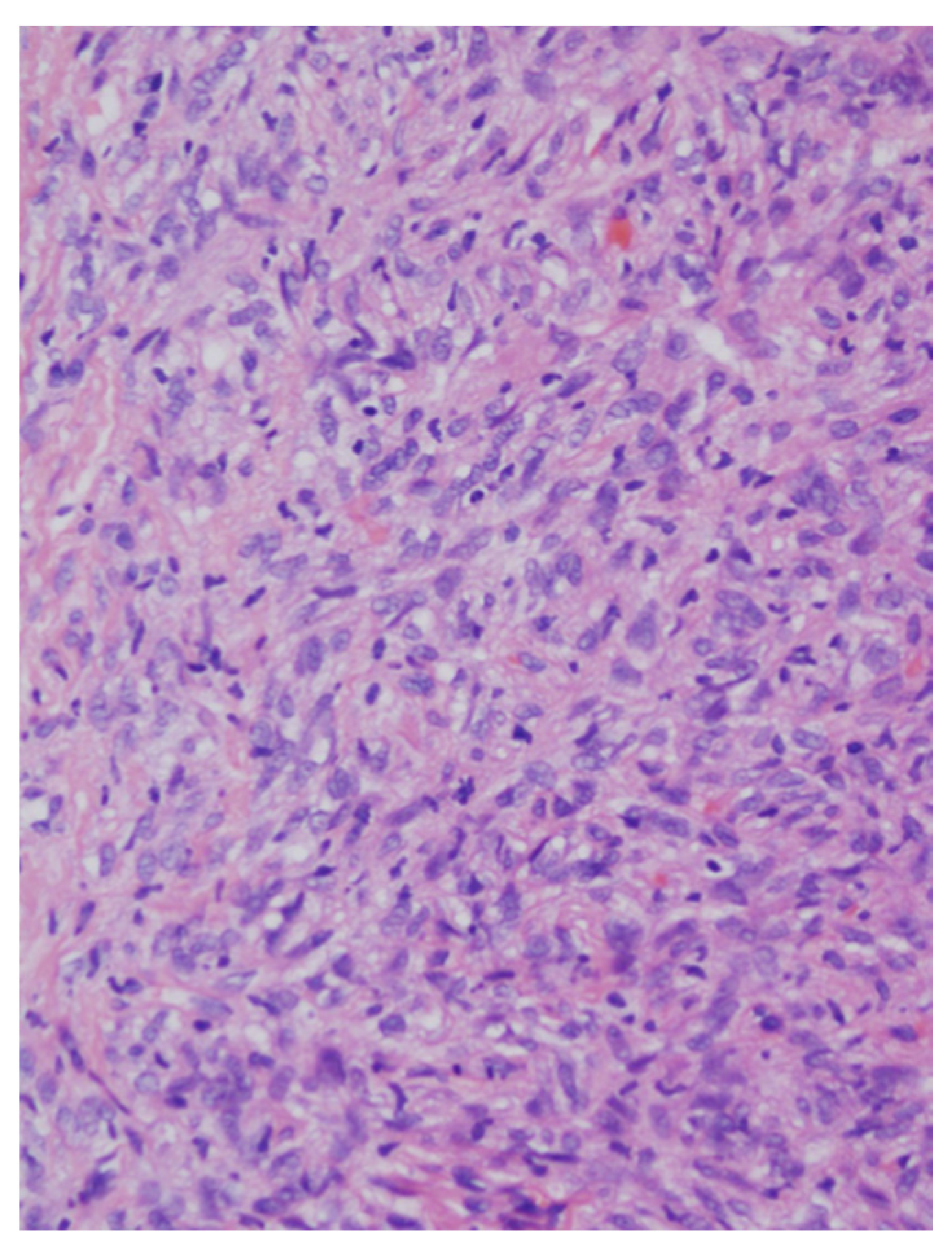 Medicina 57 00152 g004