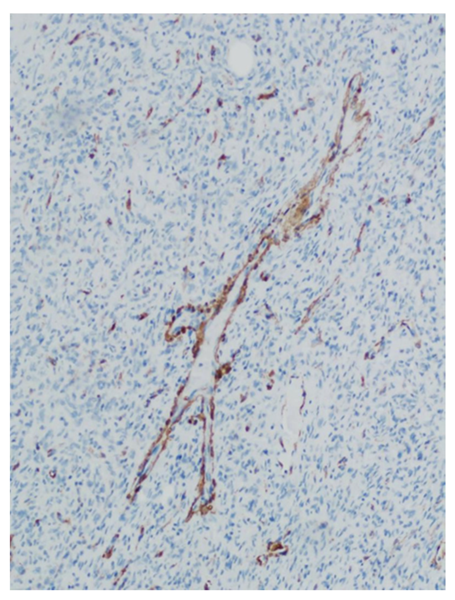 Medicina 57 00152 g006