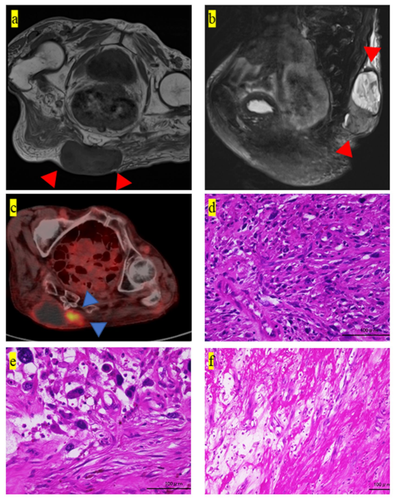 Medicina 57 00175 g001