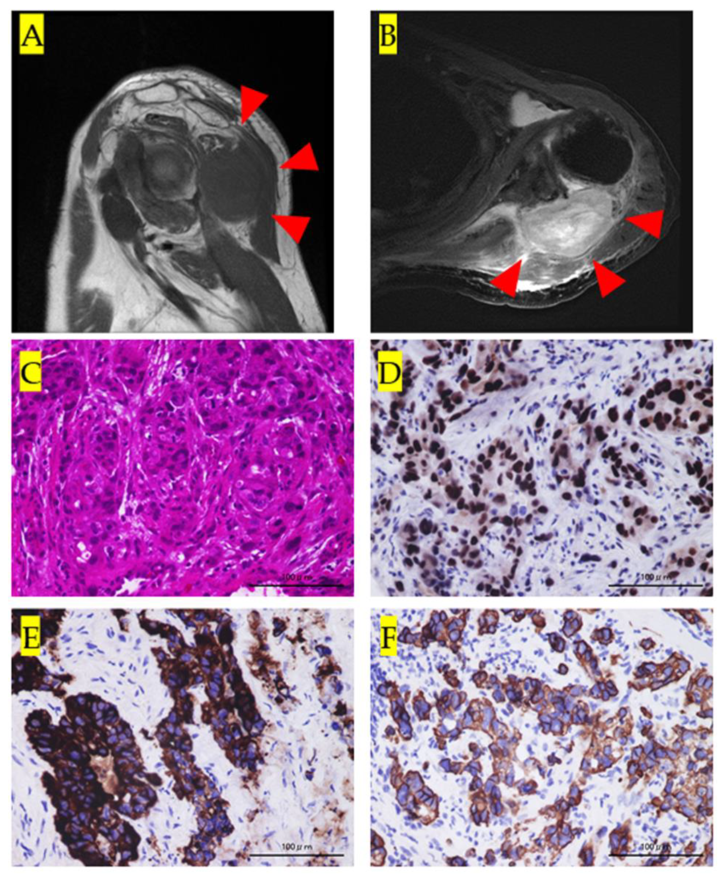 Medicina 57 00181 g001 Medicina 57 00181 g001