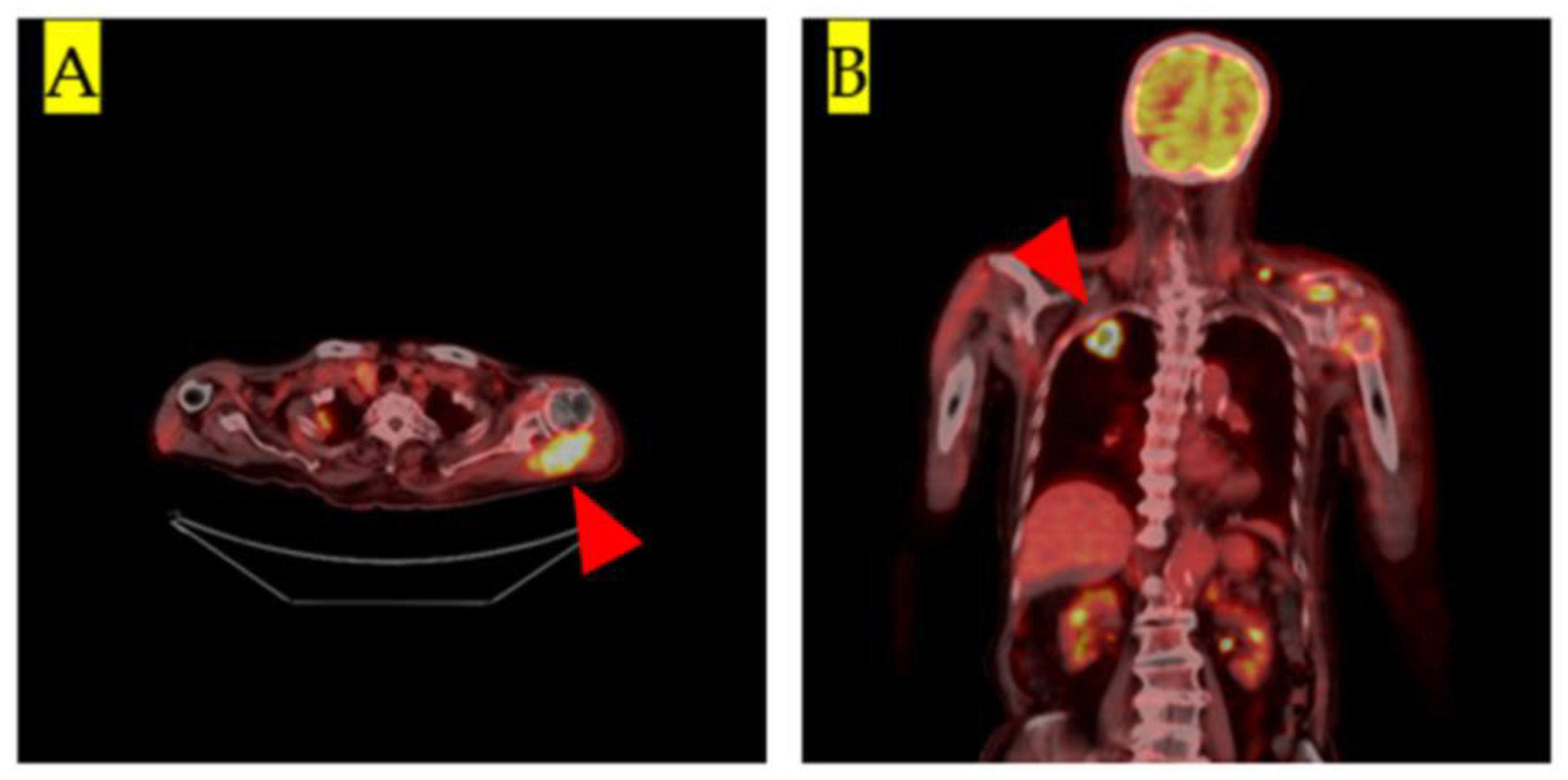 Medicina 57 00181 g002 Medicina 57 00181 g002