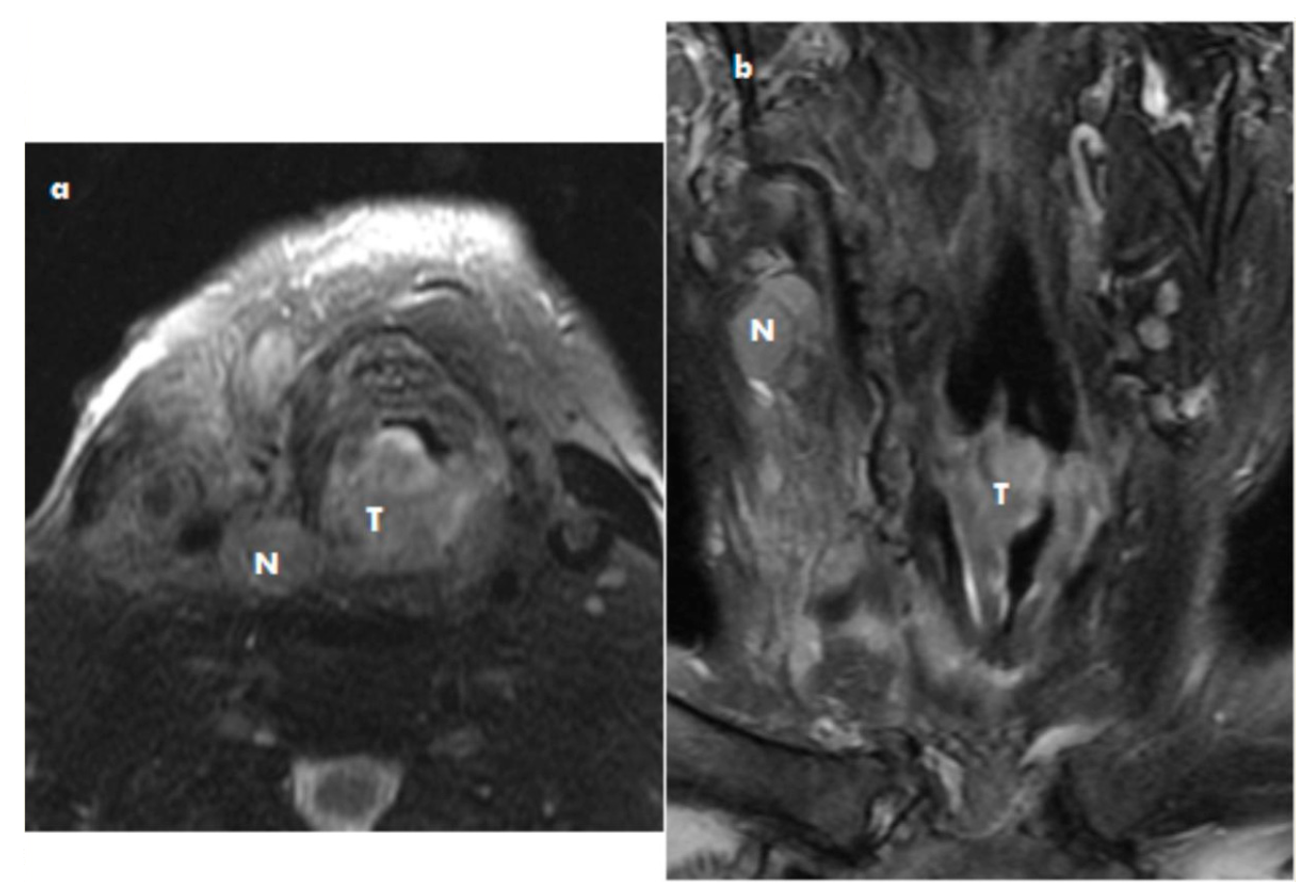 Medicina 57 00192 g003