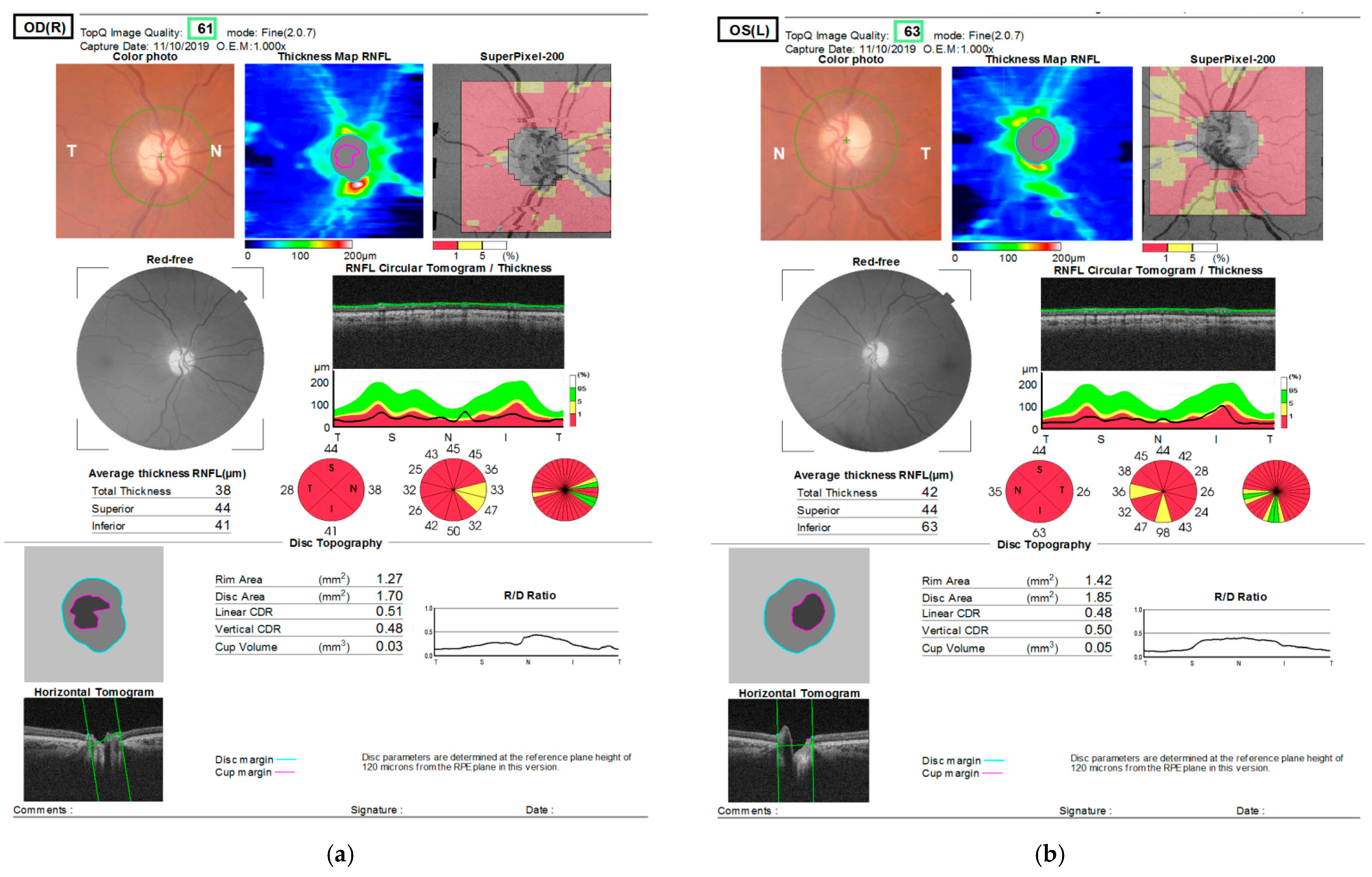 Medicina 57 00202 g004