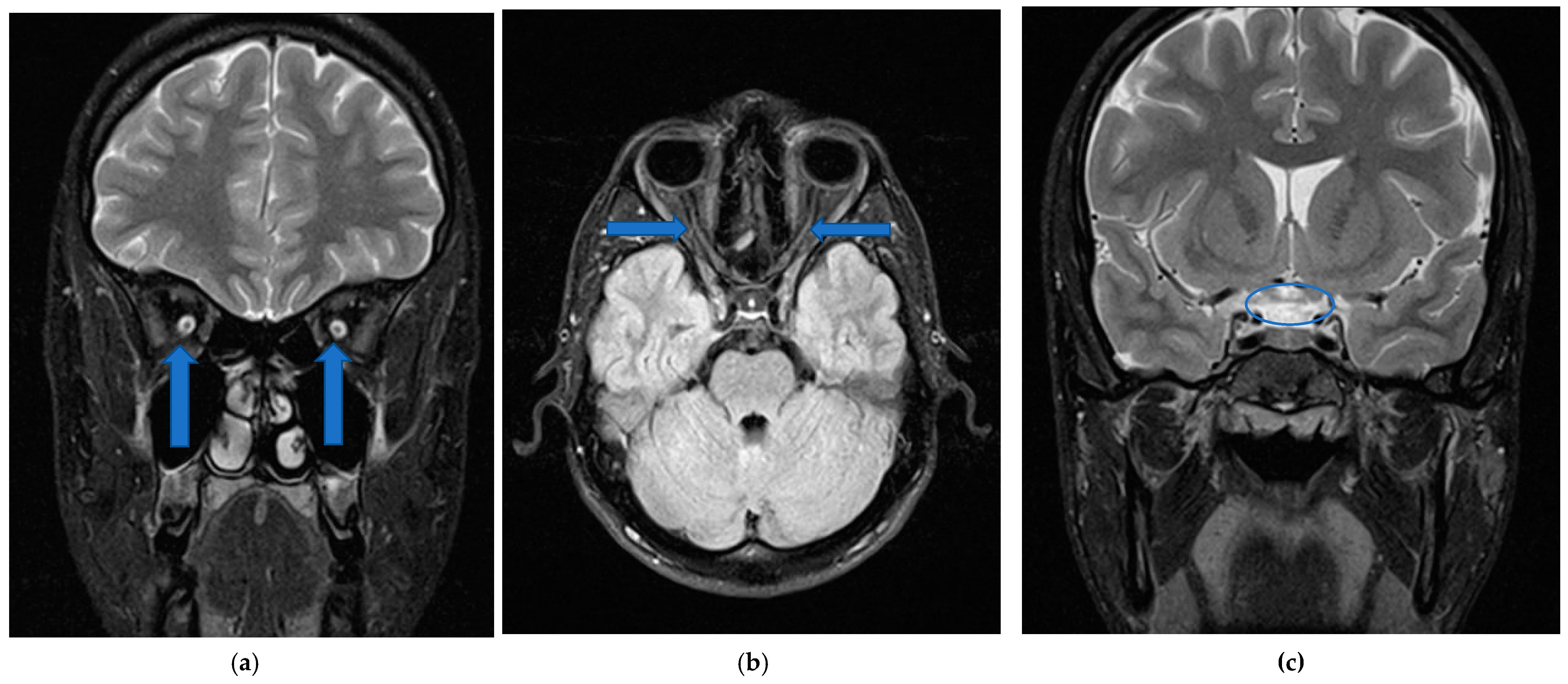 Medicina 57 00202 g005