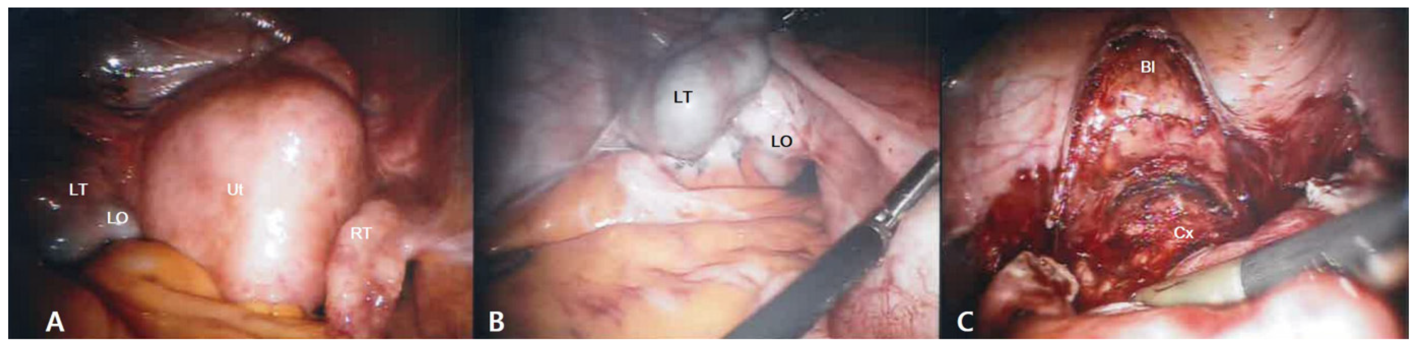 Medicina 57 00207 g003 Medicina 57 00207 g003
