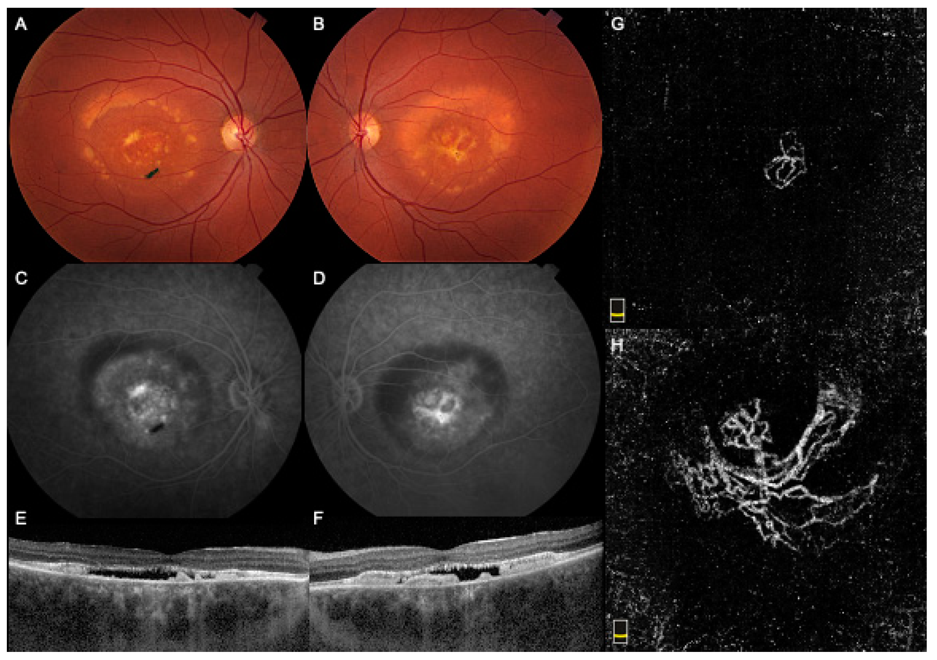 Medicina 57 00213 g002 550