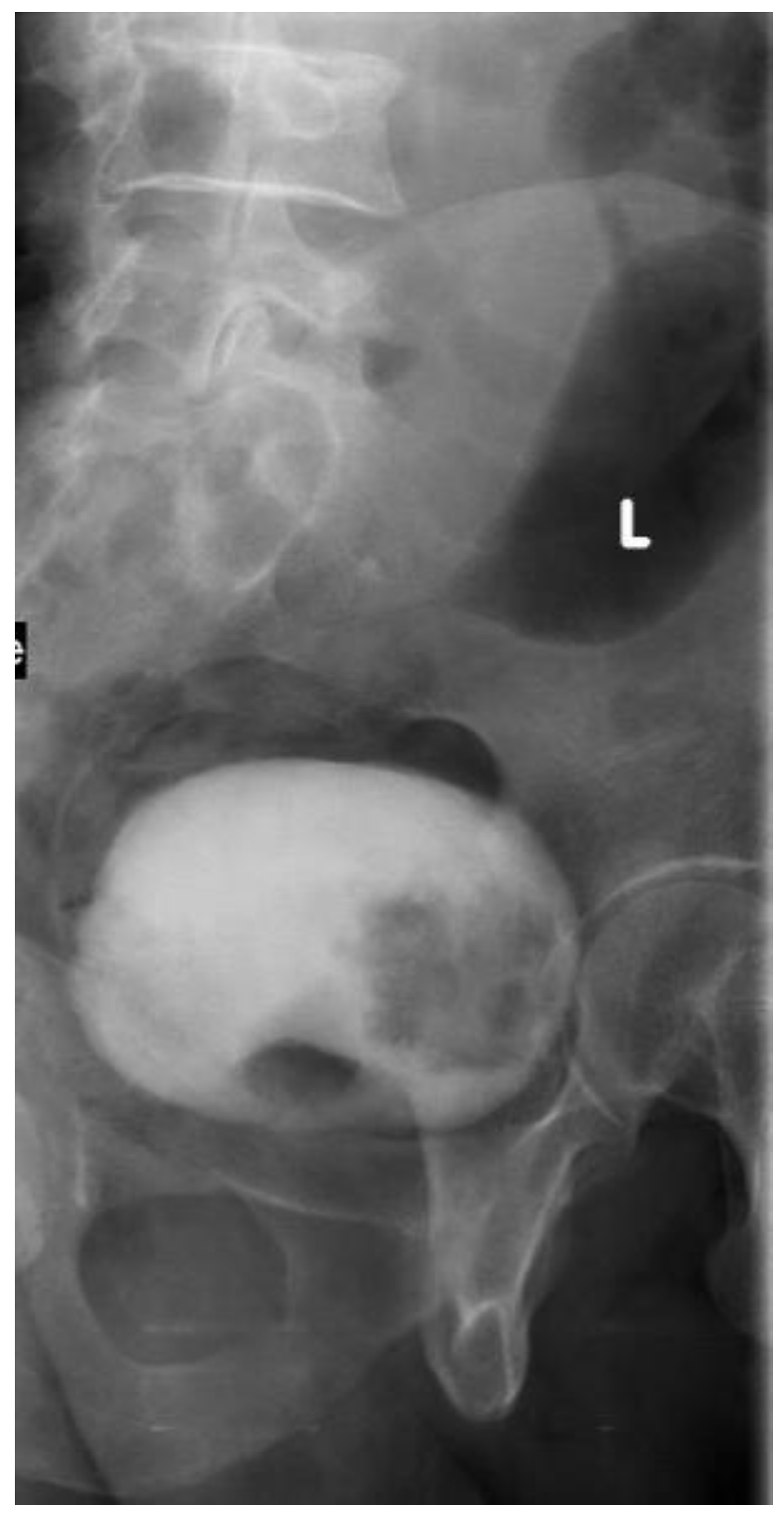 Medicina 57 00220 g002 Medicina 57 00220 g002