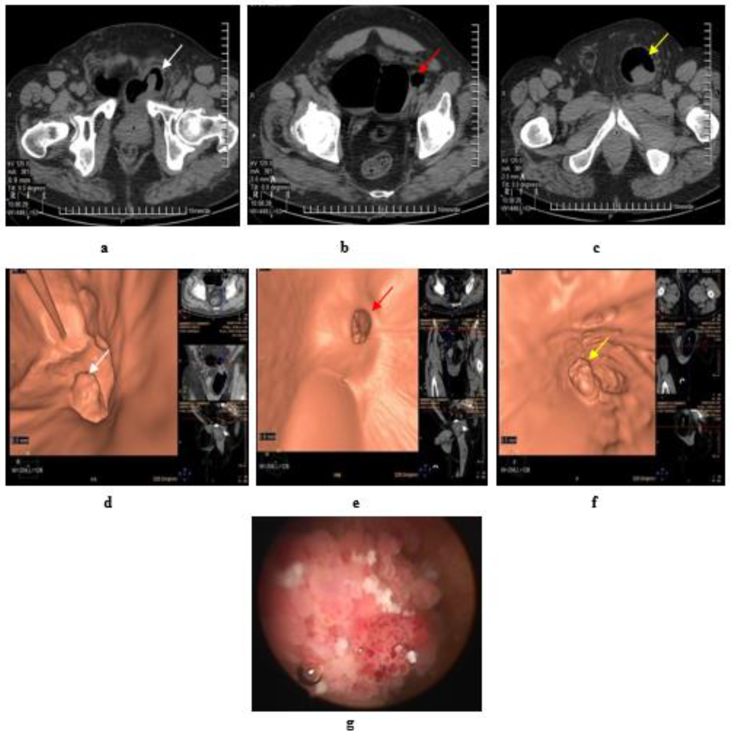 Medicina 57 00220 g005 Medicina 57 00220 g005