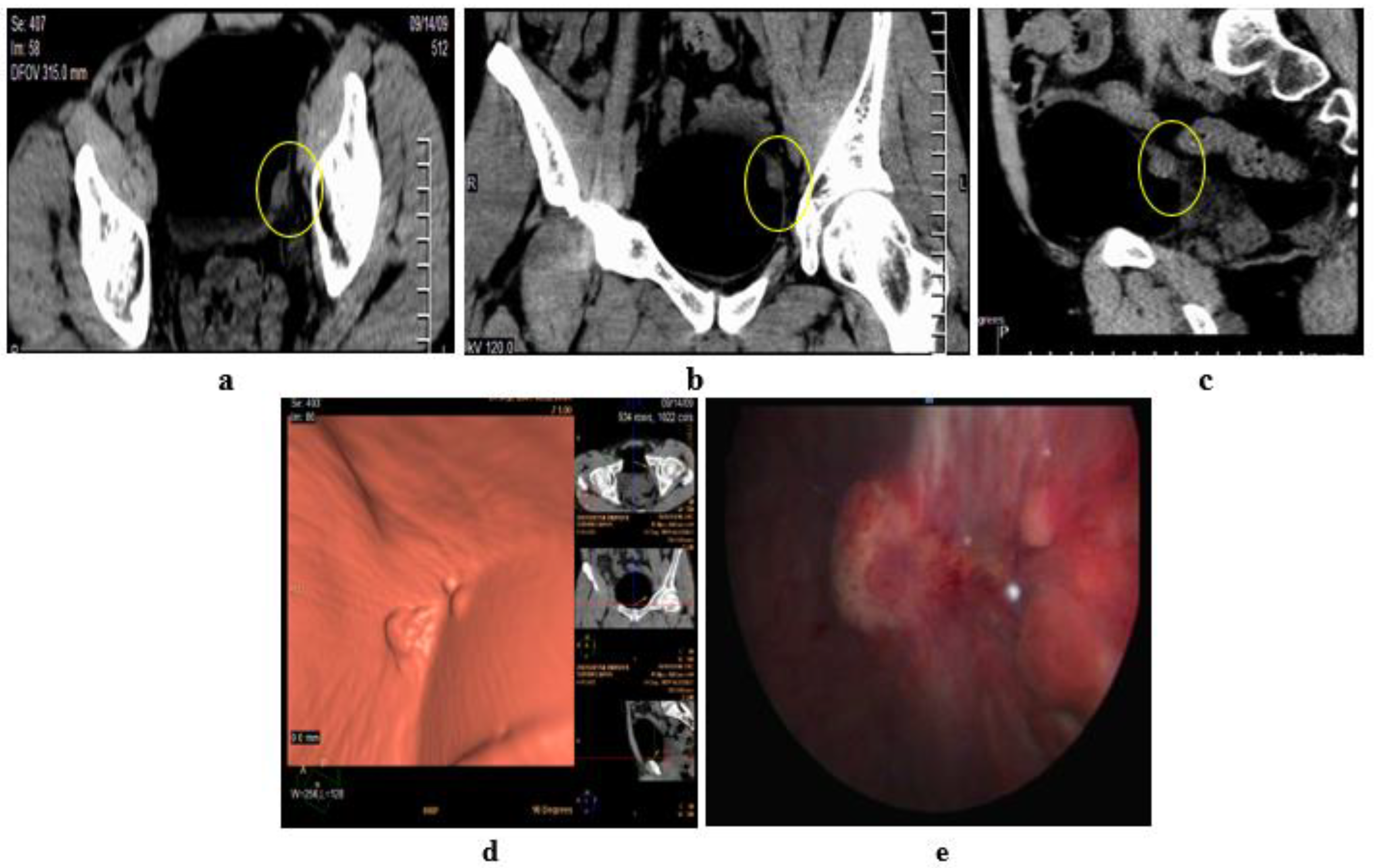Medicina 57 00220 g006 Medicina 57 00220 g006