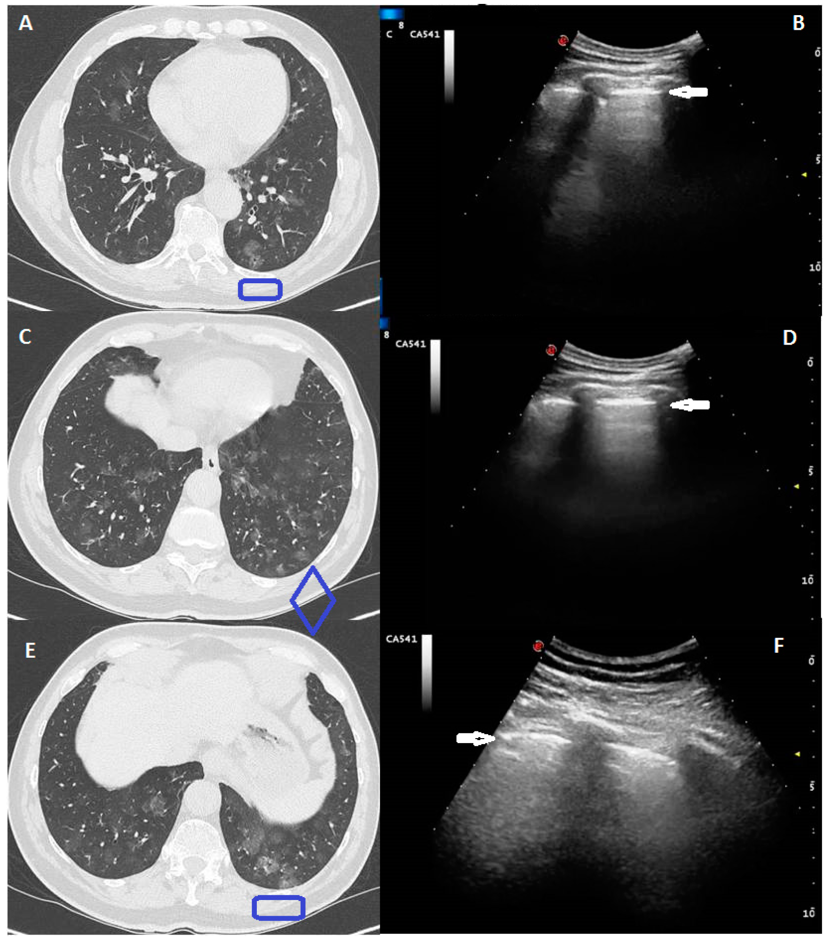 Medicina 57 00236 g001 Medicina 57 00236 g001
