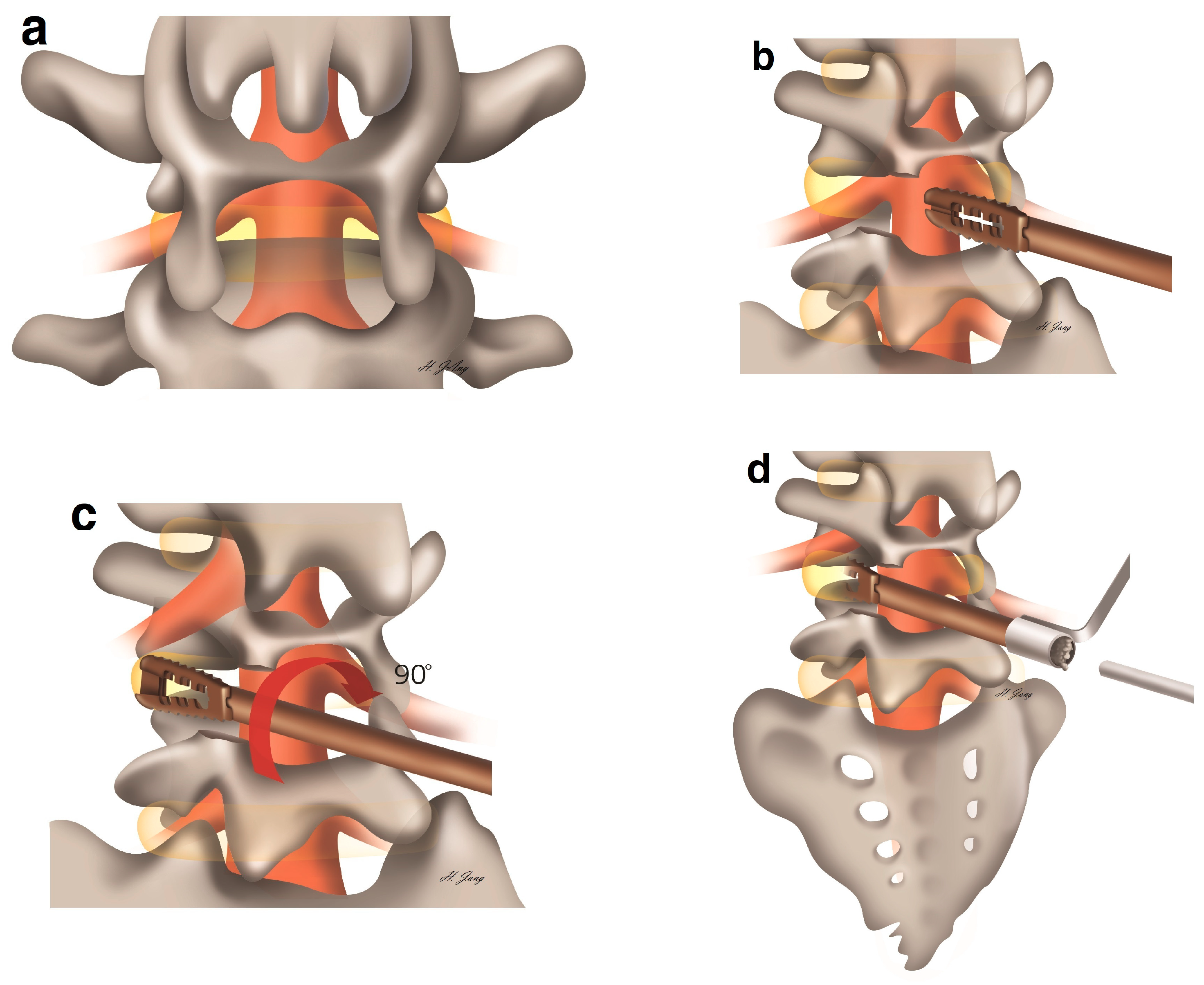 Medicina 57 00237 g001 Medicina 57 00237 g001
