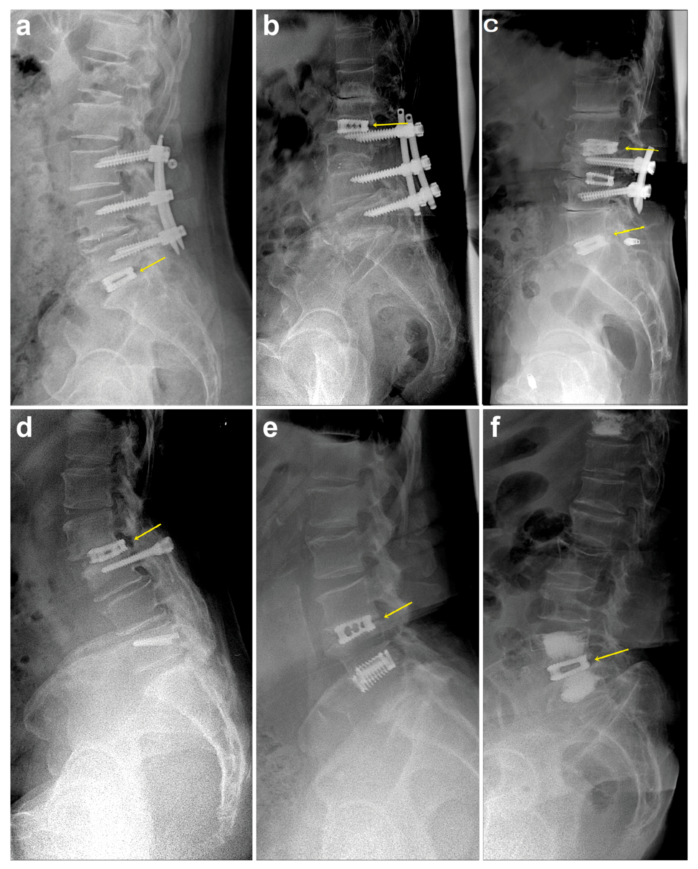 Medicina 57 00237 g003 Medicina 57 00237 g003