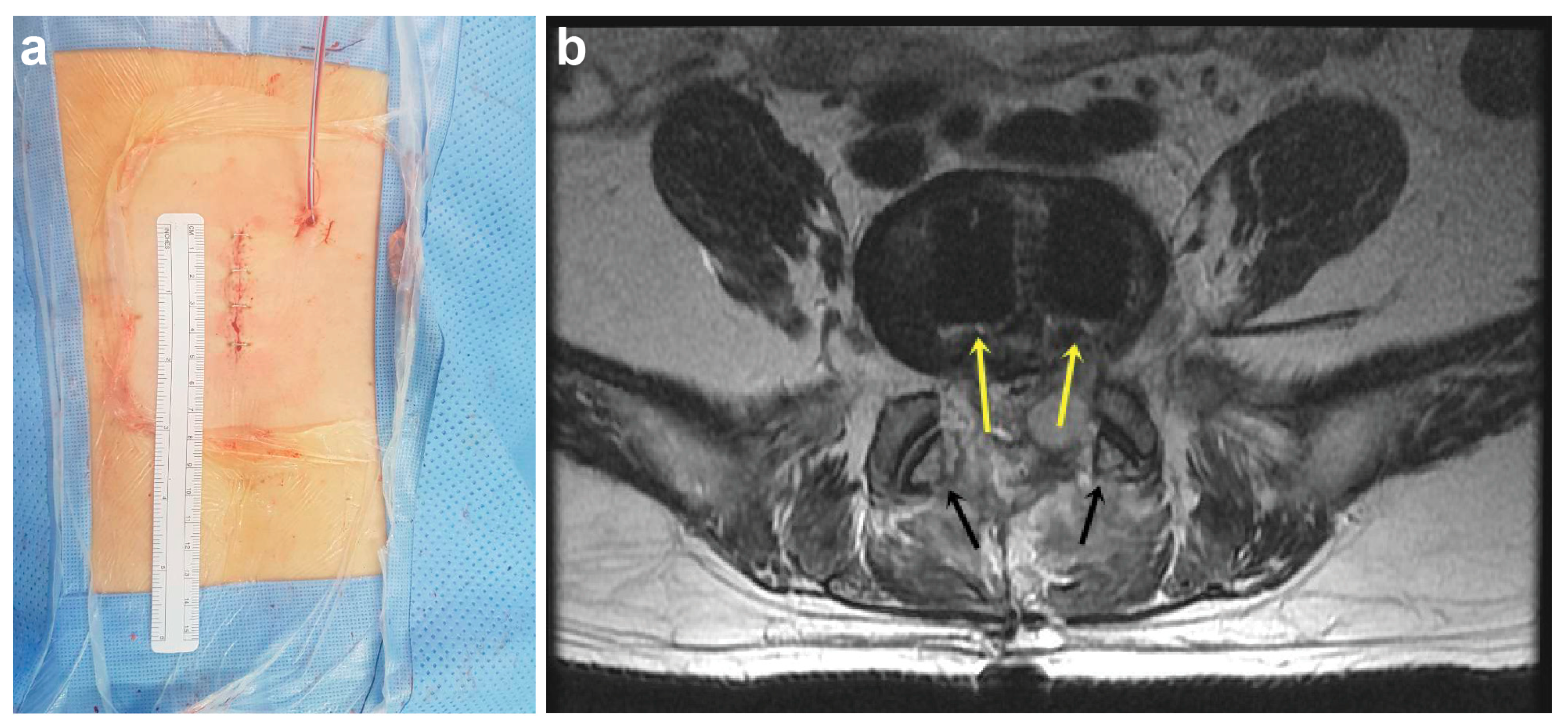 Medicina 57 00237 g004 Medicina 57 00237 g004