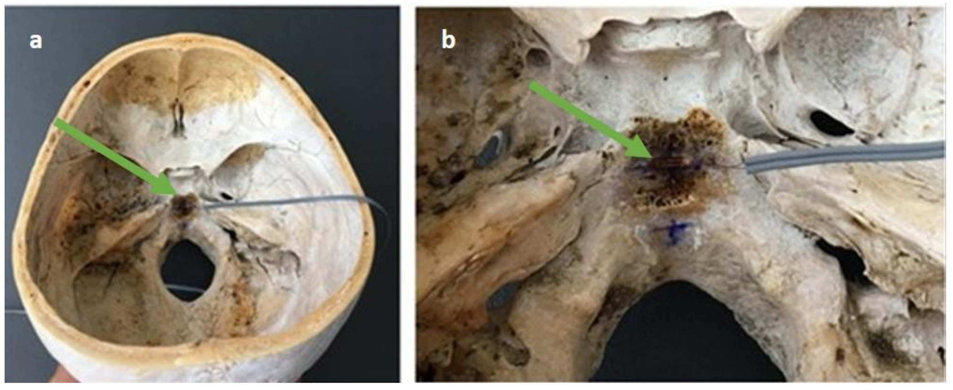 Medicina 57 00246 g001
