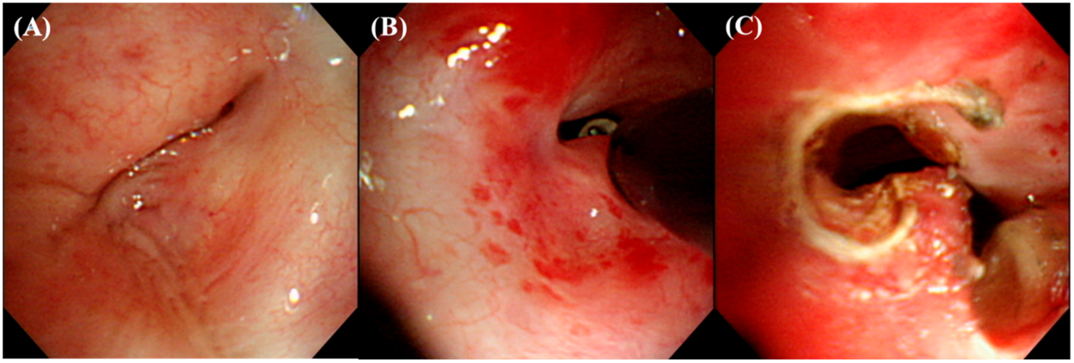 Medicina 57 00251 g002