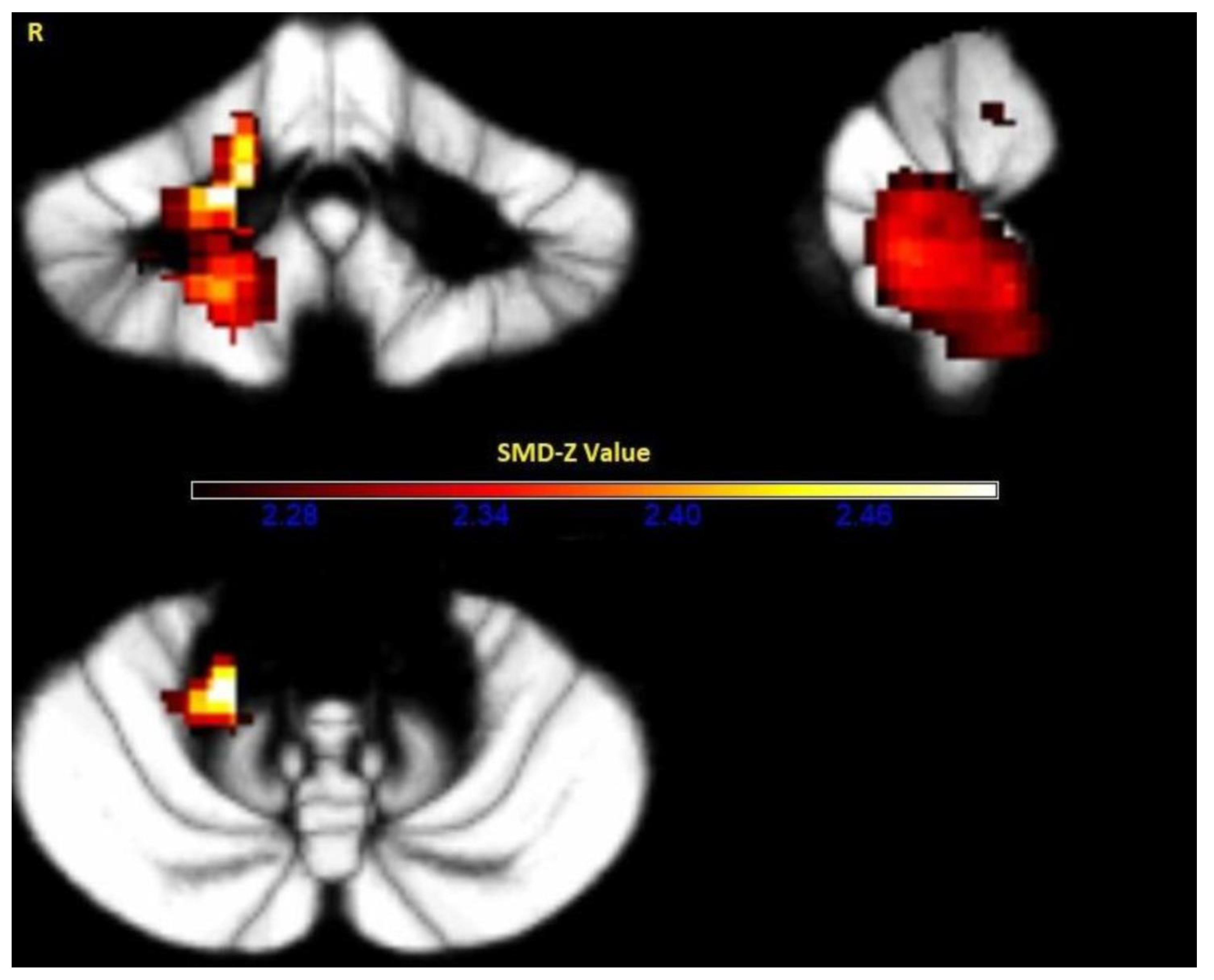 Medicina 57 00264 g003